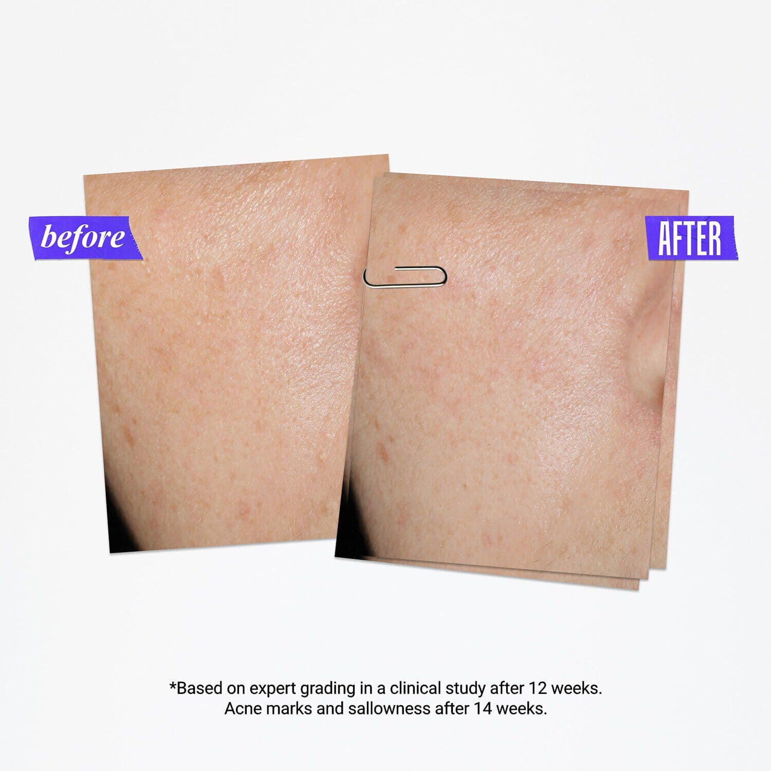 Clearly Corrective Dark Spots Correcting Serum