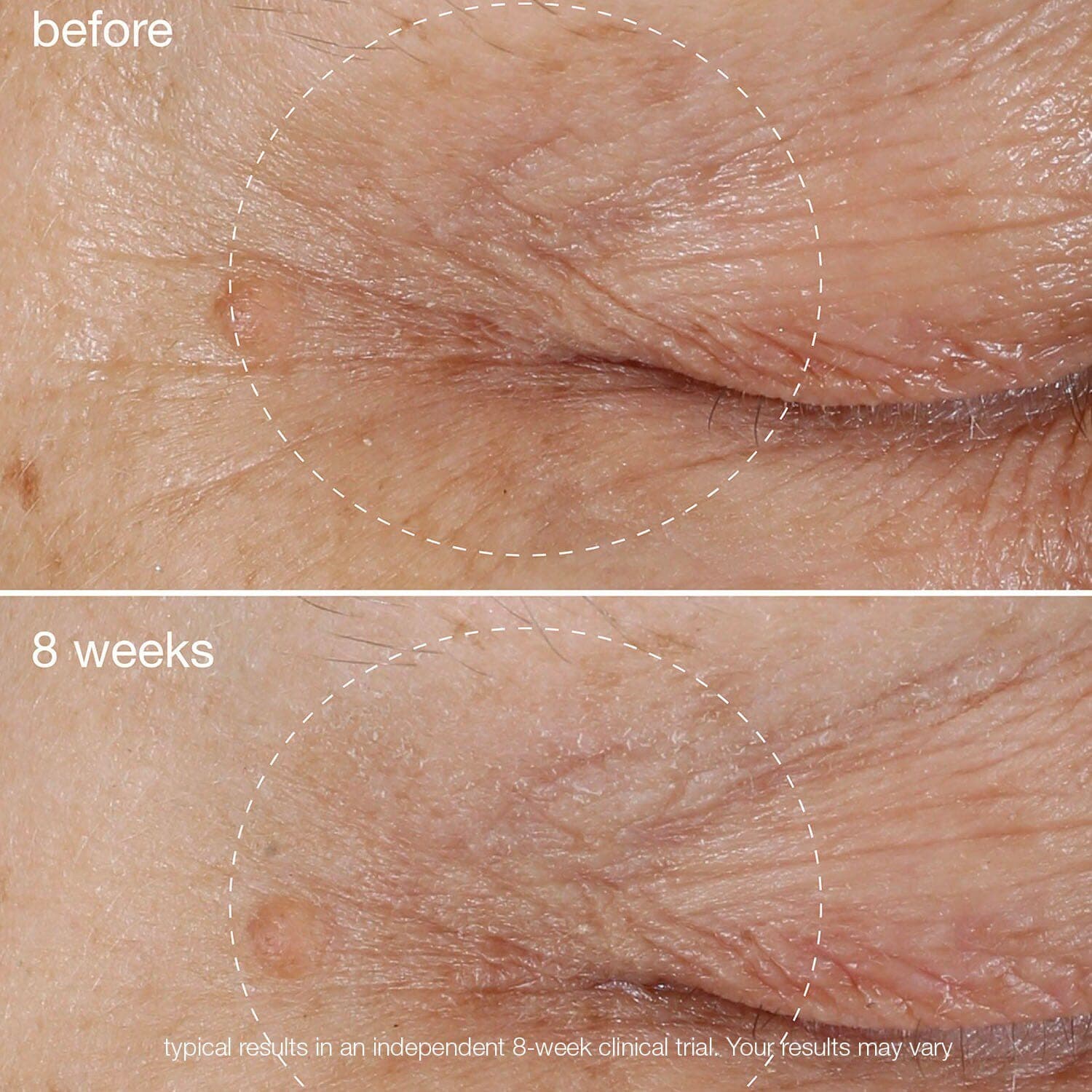 Biolumin-C Vitamin C Eye Serum