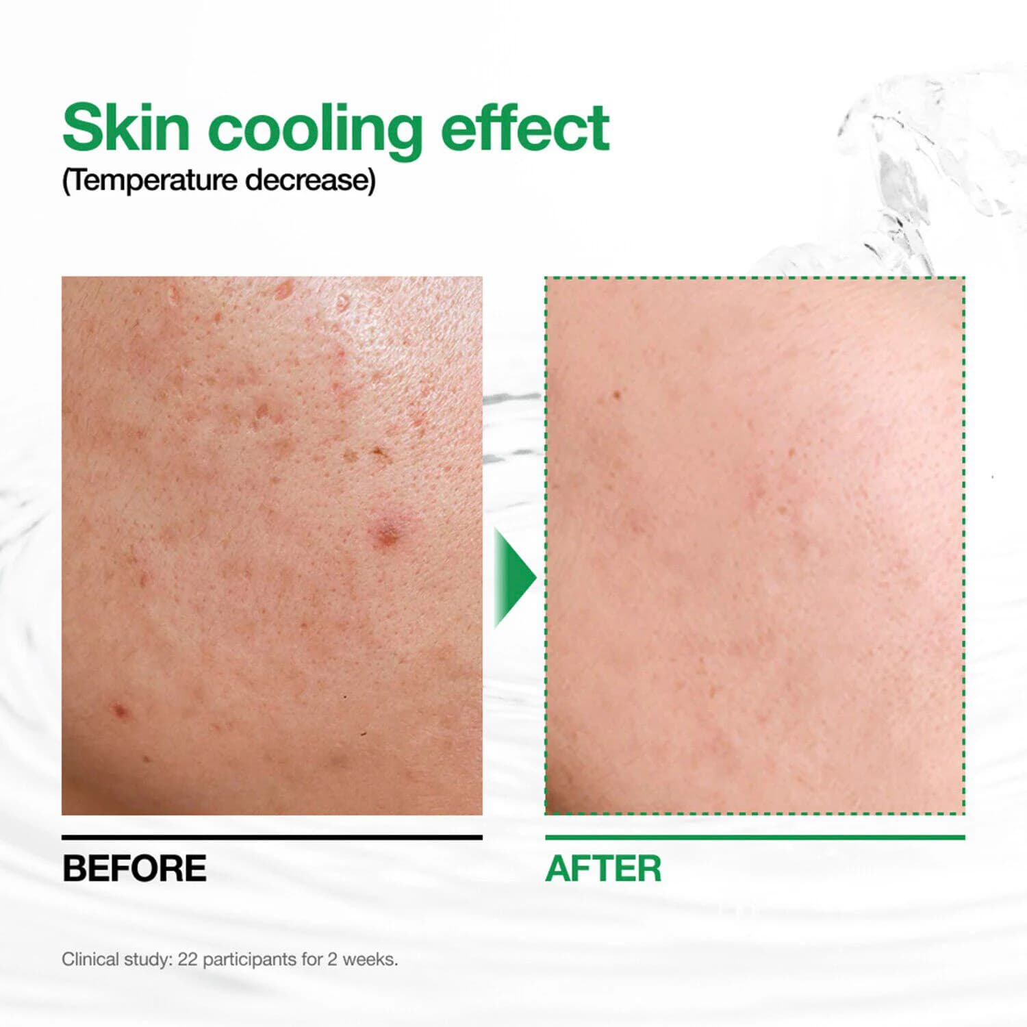 Heartleaf 77 Soothing Toner