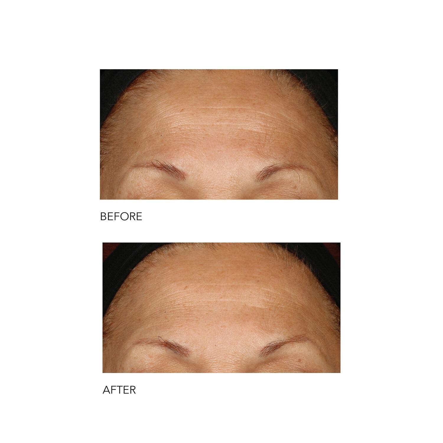 Alpha Beta® Peel Extra Strength Daily Peel