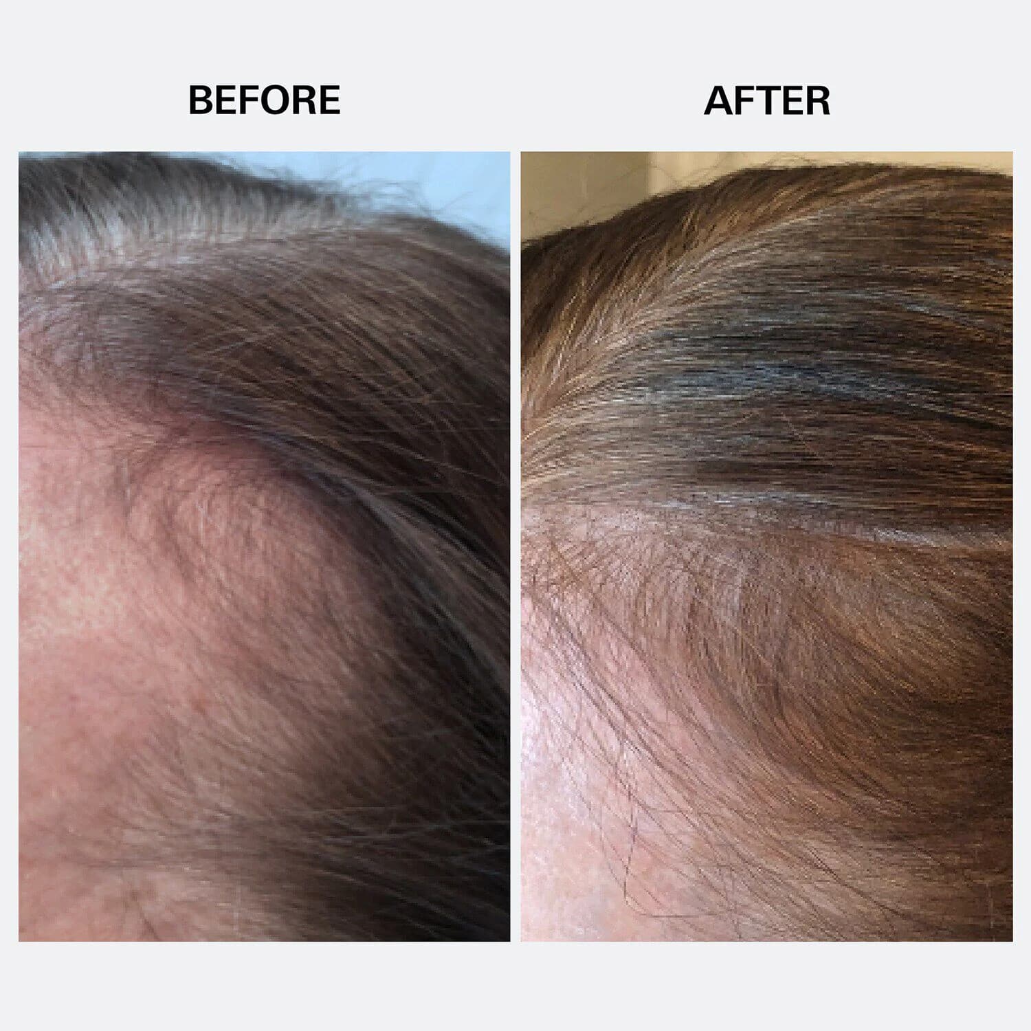 Youth Juice Collagen Scalp Treatment