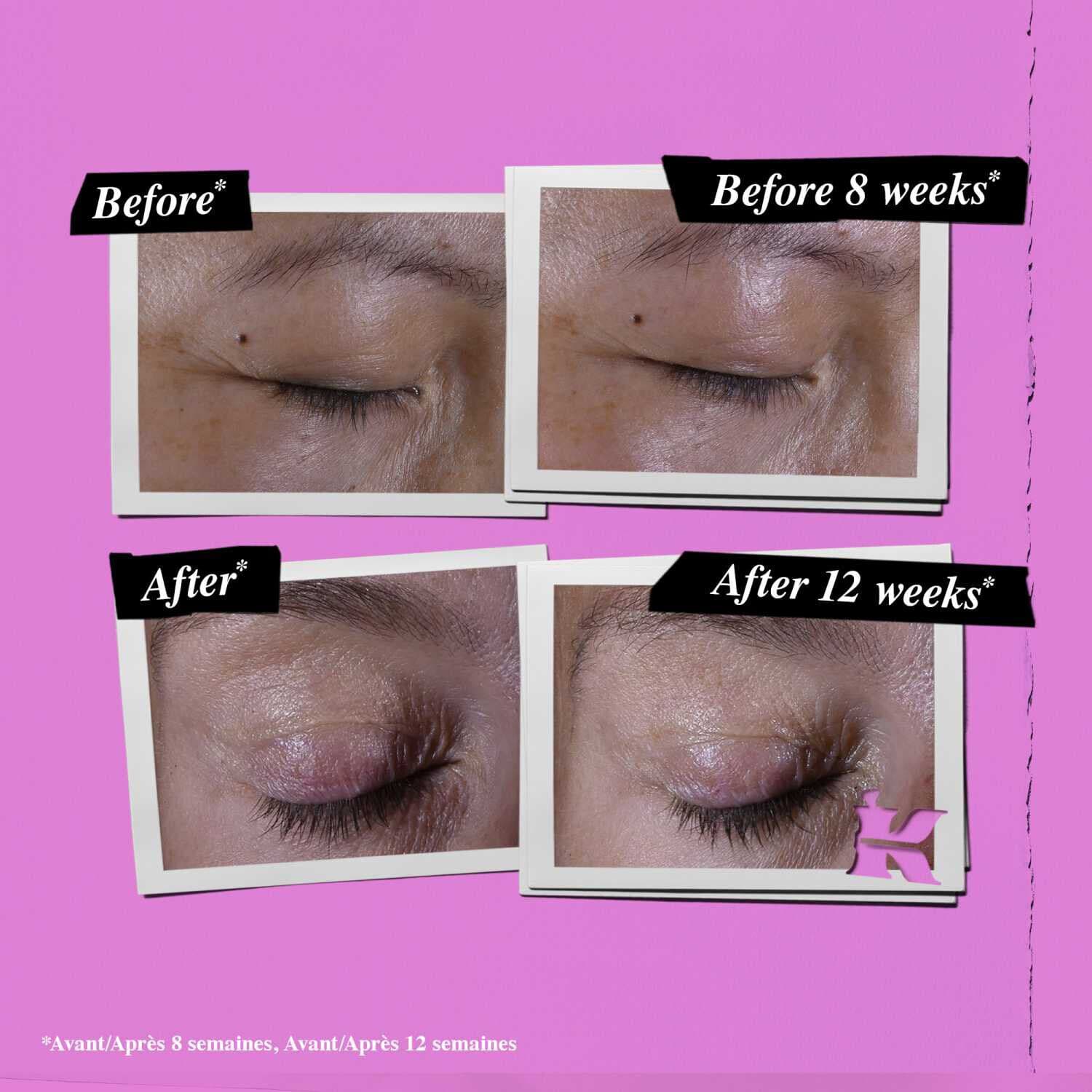 Super Multi-Corrective Anti-Aging Eye Cream