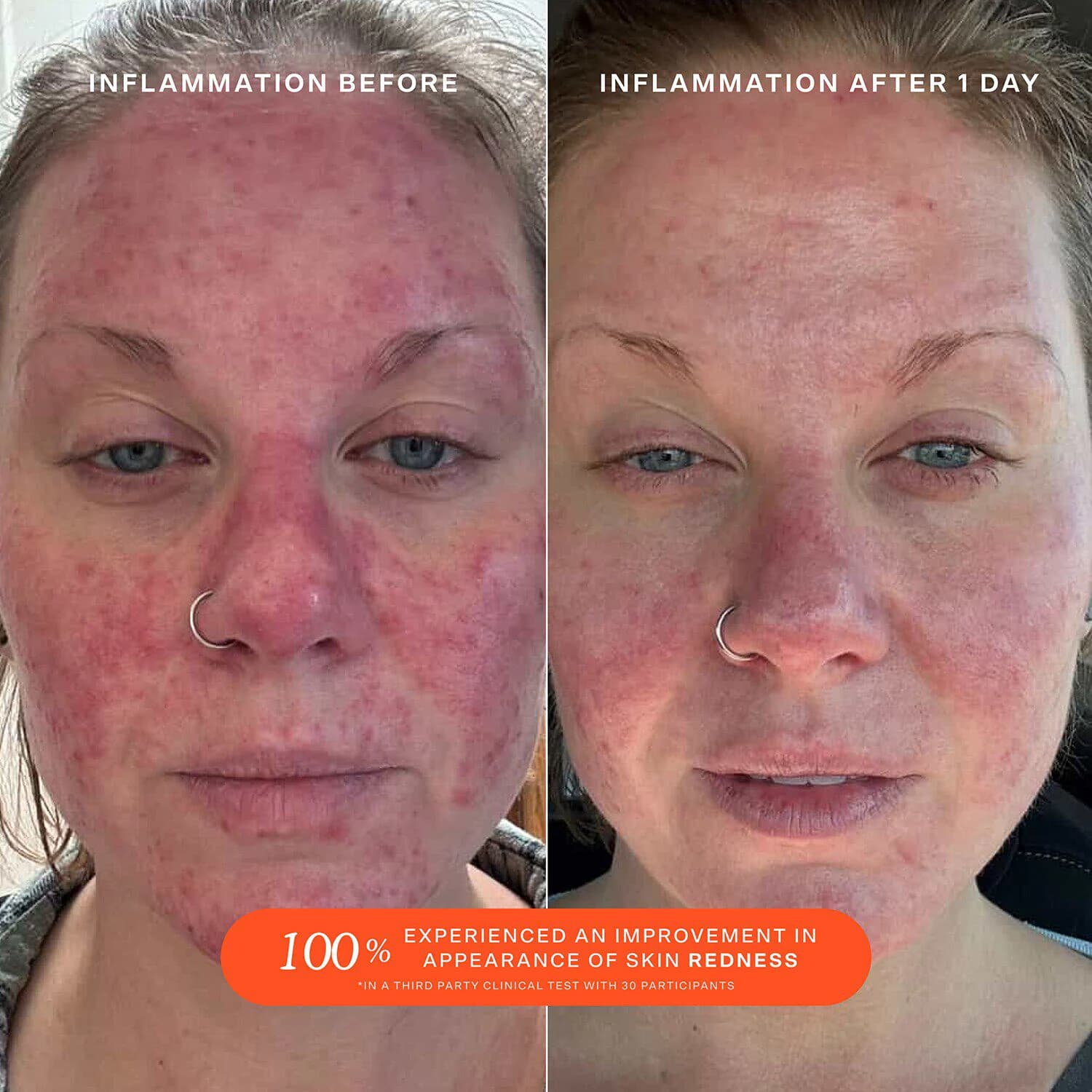 SOS Daily Rescue Facial Spray