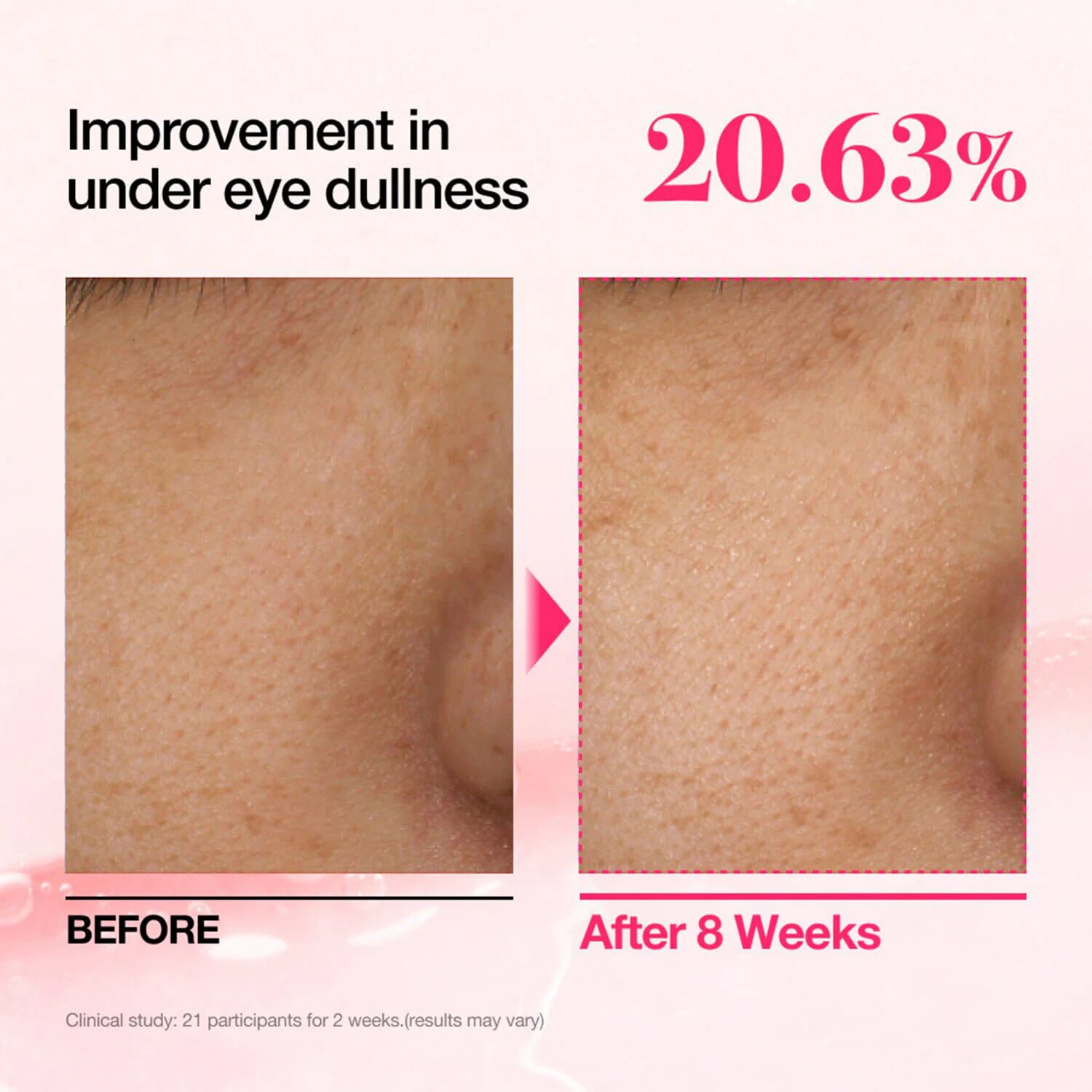 Niacinamide 5 TXA Brightening Pad