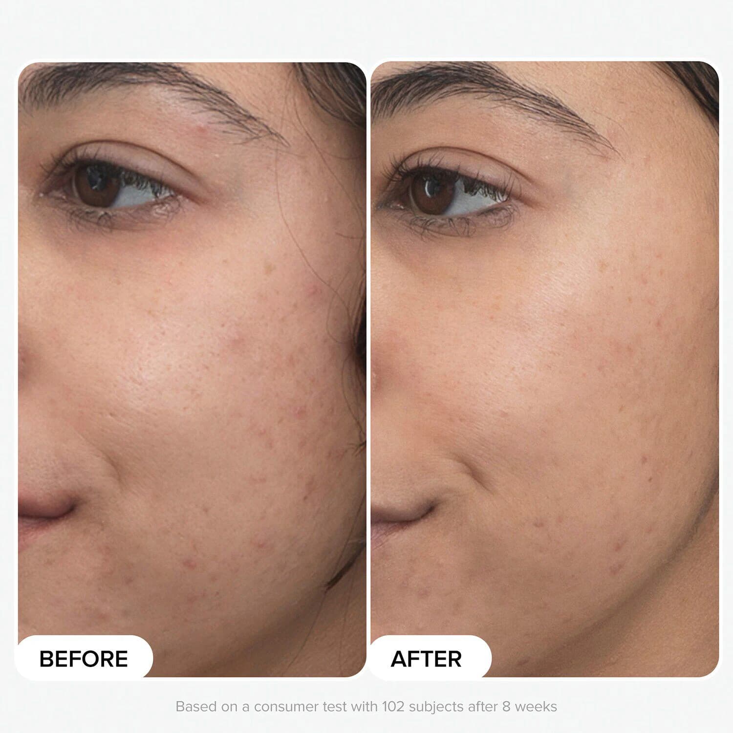 Clinical Pro Retinaldehyde Dual-Retinoid Treatment