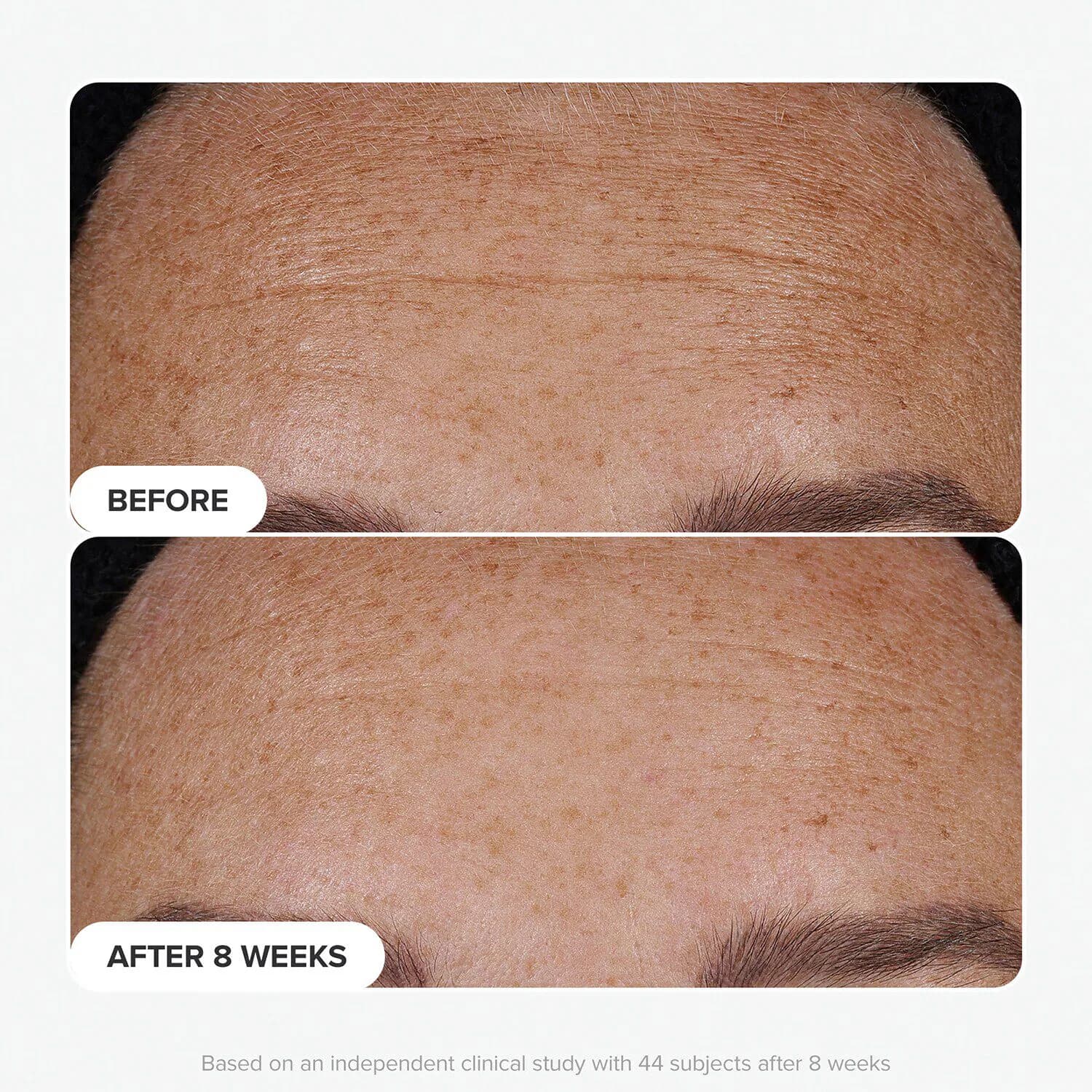 Clinical Pro Retinaldehyde Dual-Retinoid Treatment