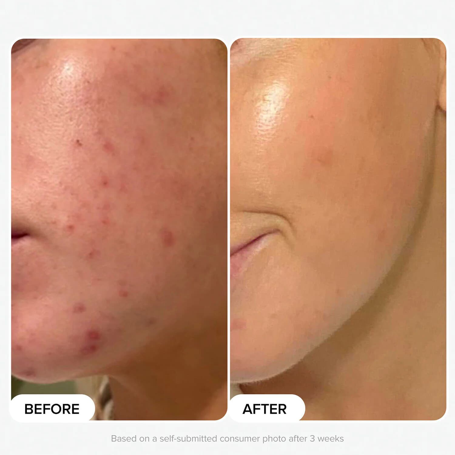 Skin Perfecting 2% BHA Liquid Exfoliant Toner