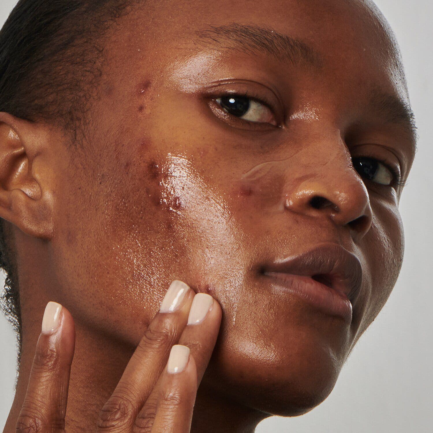 SuperSolutionsᐩ 20% Niacinamide Serum