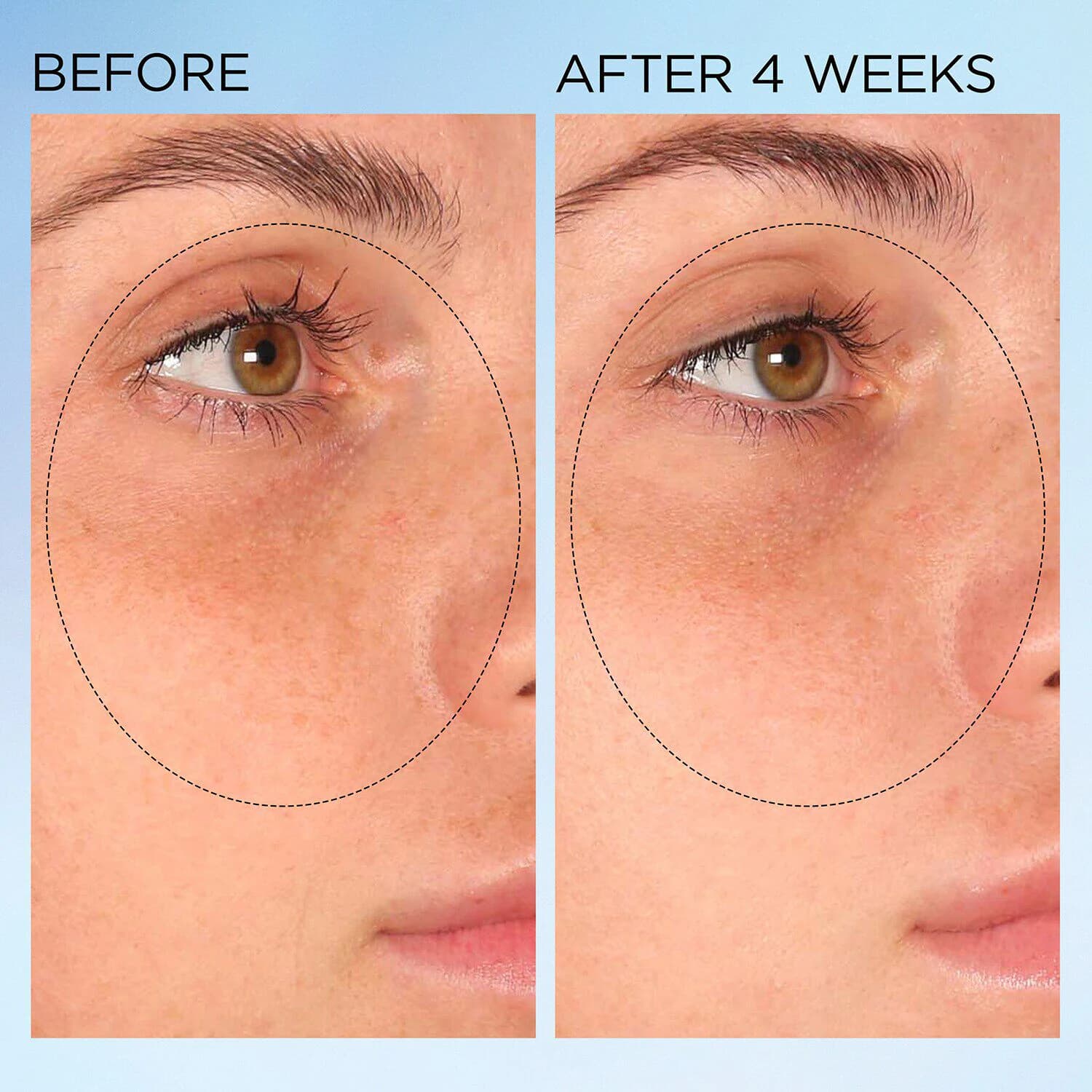 Visible Brightening Clearly Radiant Spot Correcting