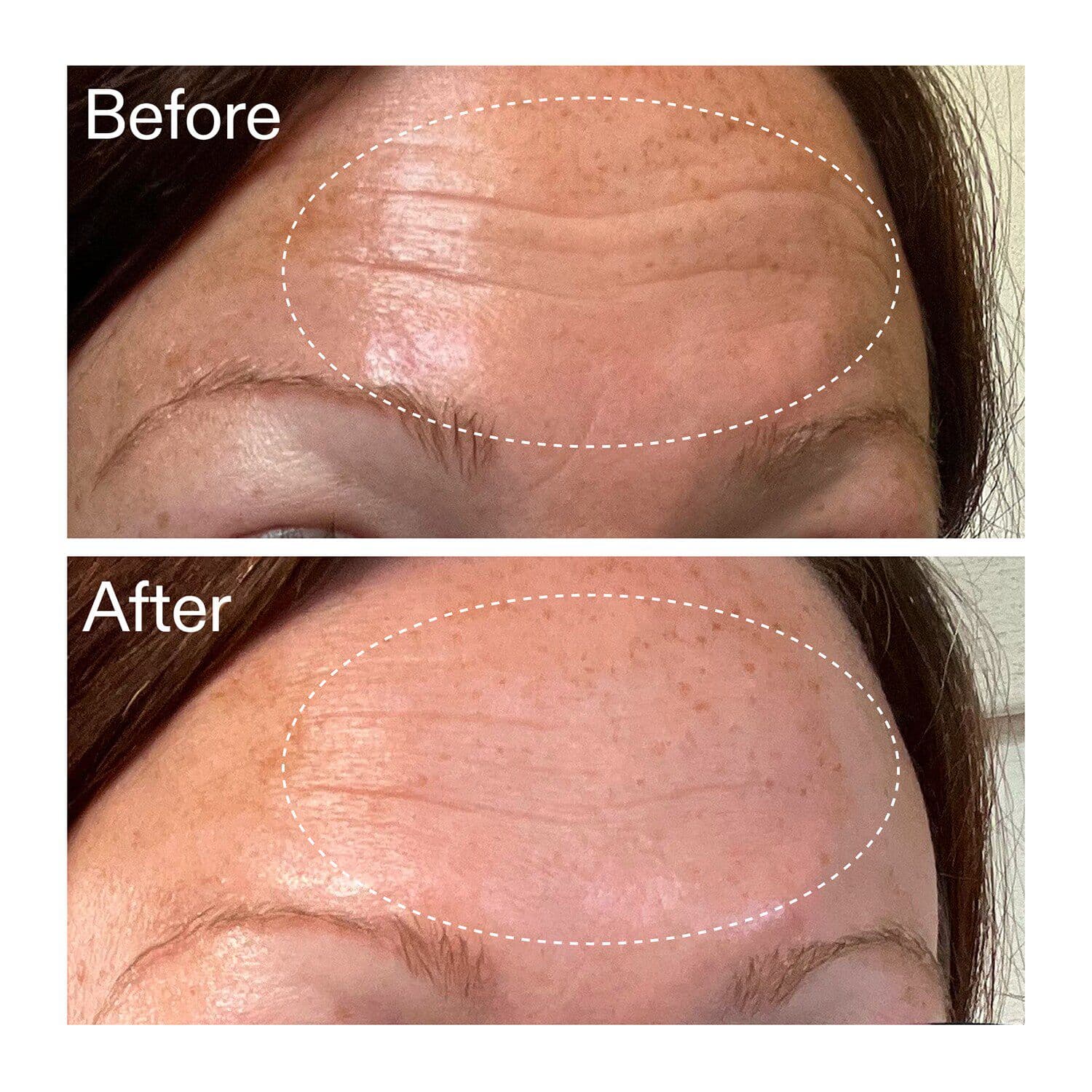 Starter Retinol Serum