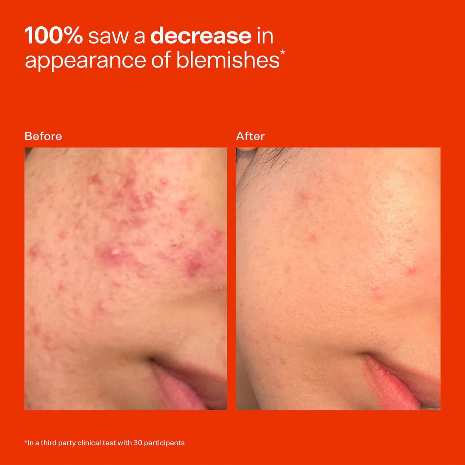 Mini SOS Daily Rescue Facial Spray