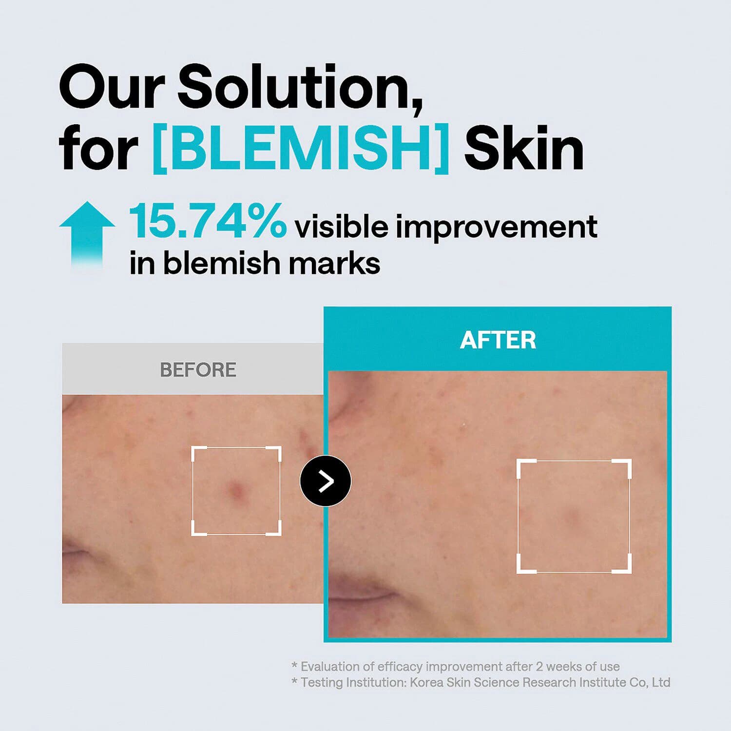 Madecassoside Blemish Pad