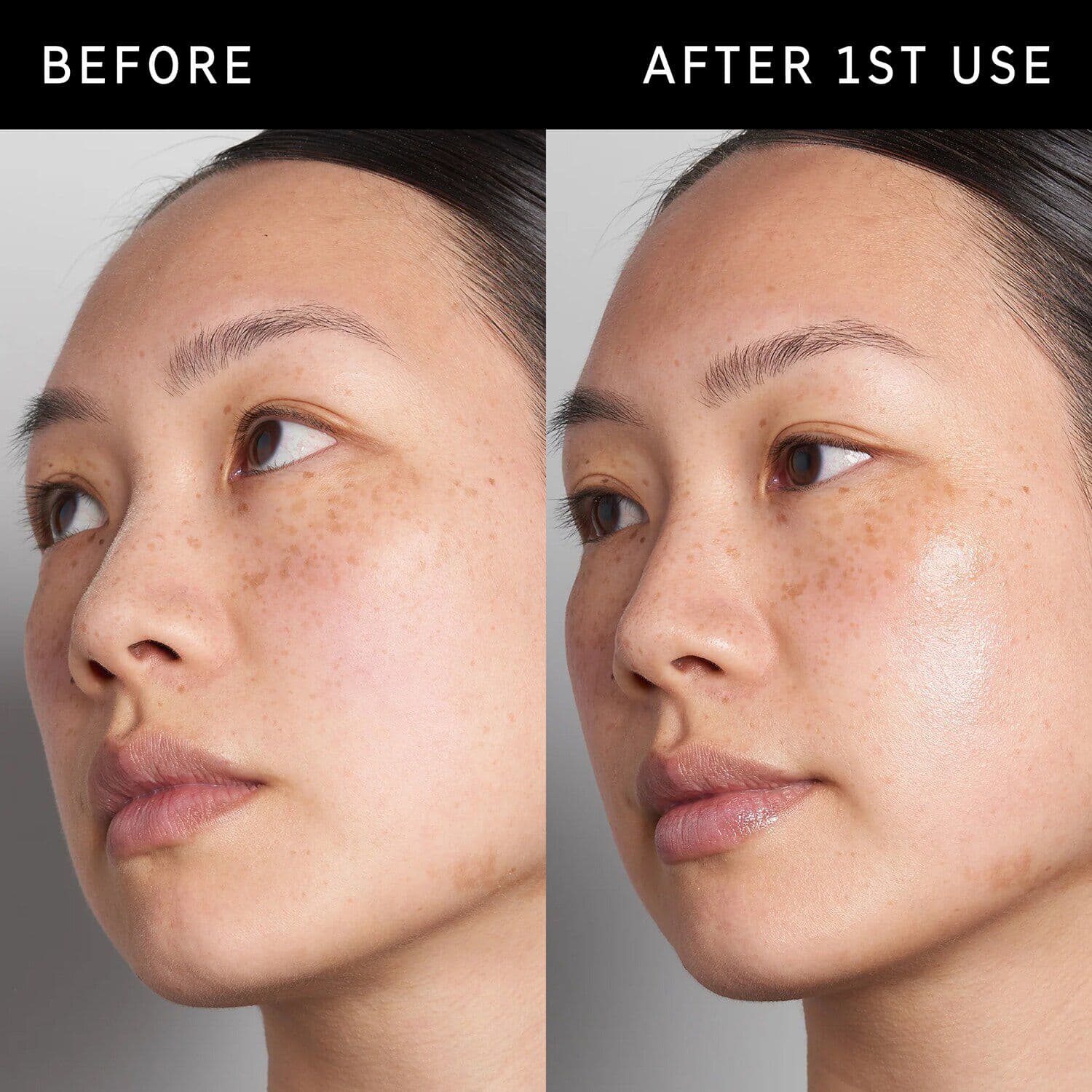 Hyaluronic Acid Serum