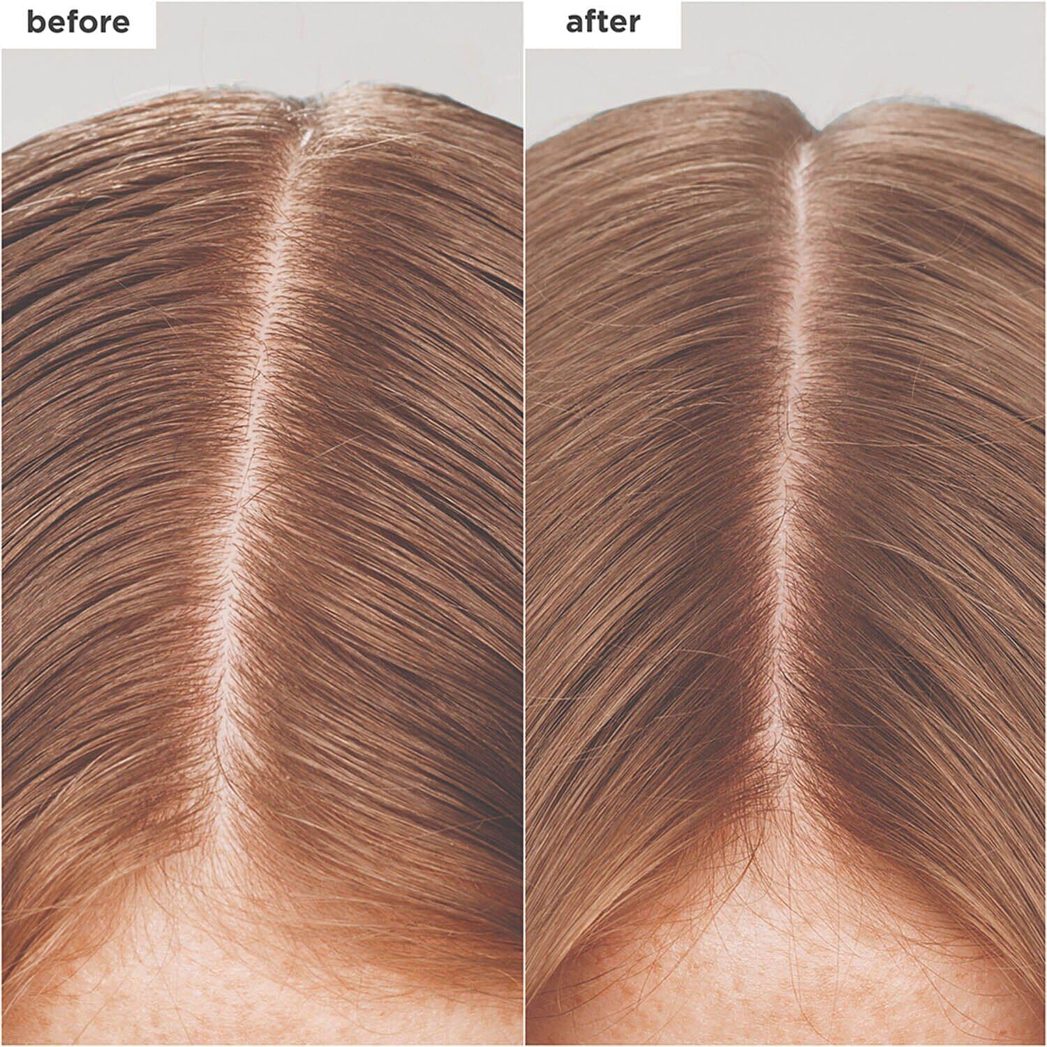 Scalp Revival™ Charcoal + Biotin Dry Shampoo