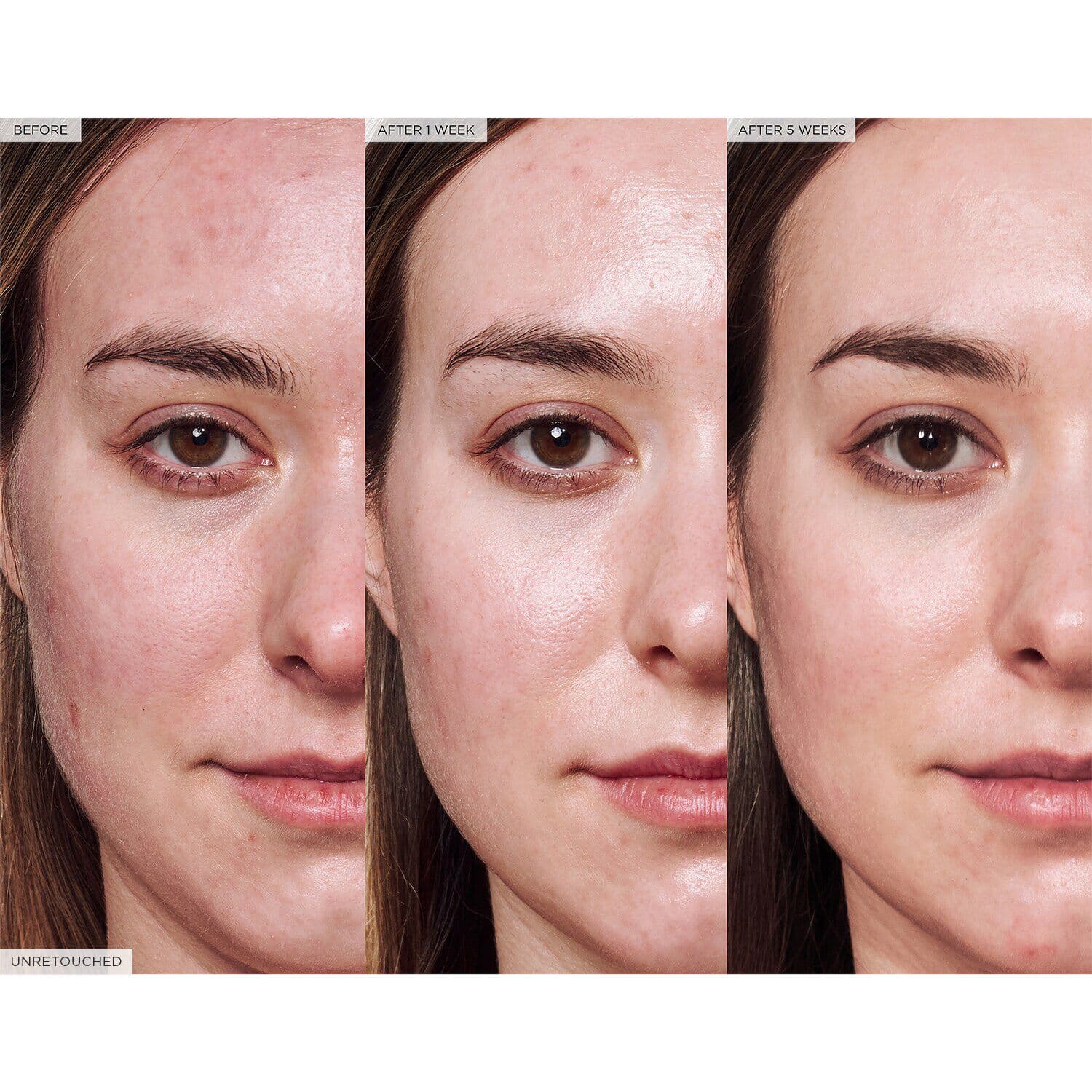 Avocado Ceramide Recovery Serum