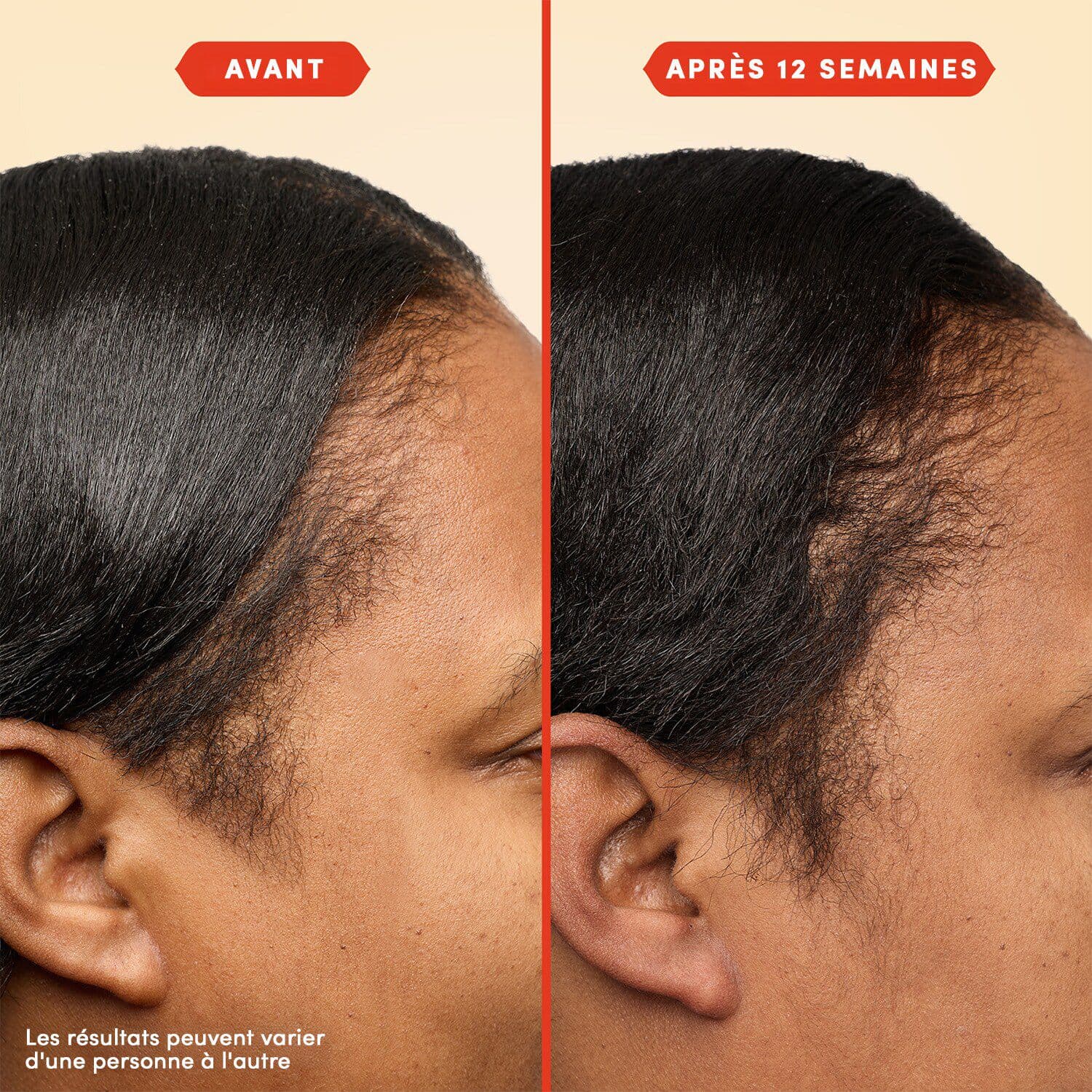 HoliRoots™ Hair Oil