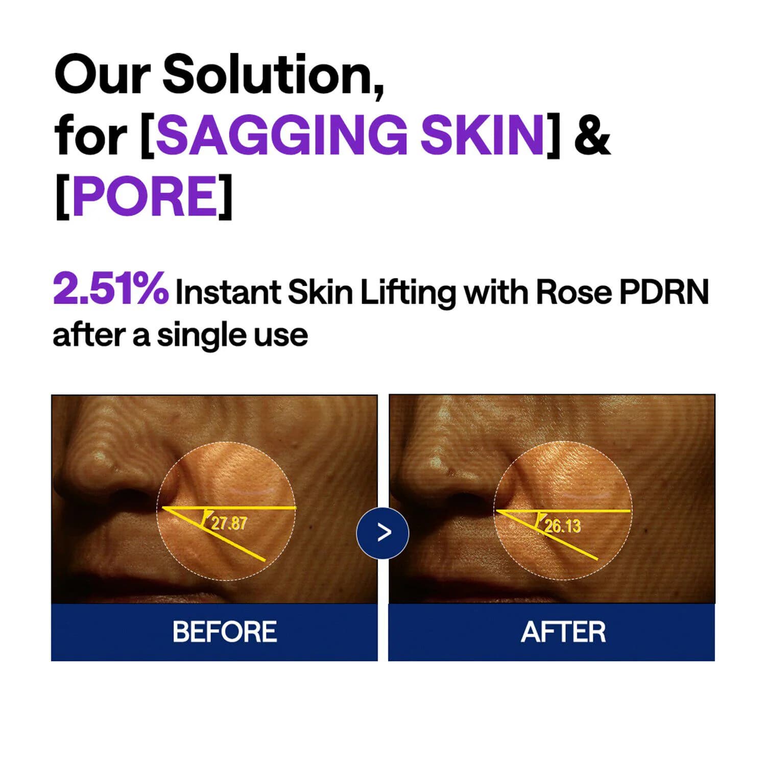 PDRN Serum