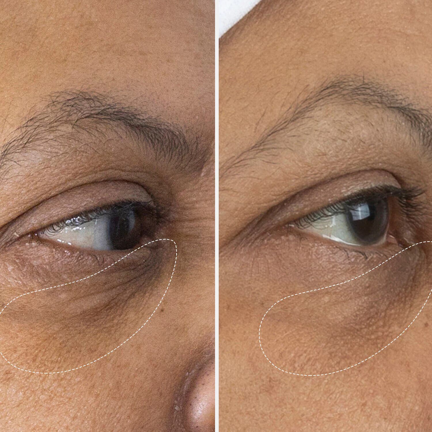 The Eye Cream