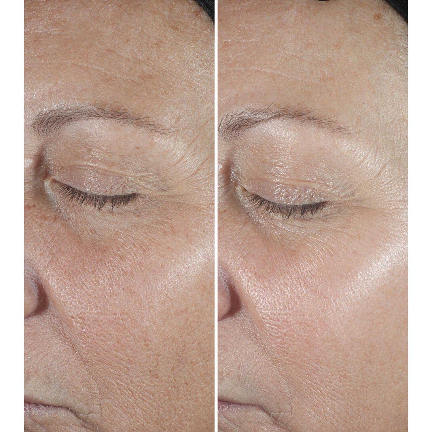 Smart Clinical Repair Wrinkle Correcting Serum 