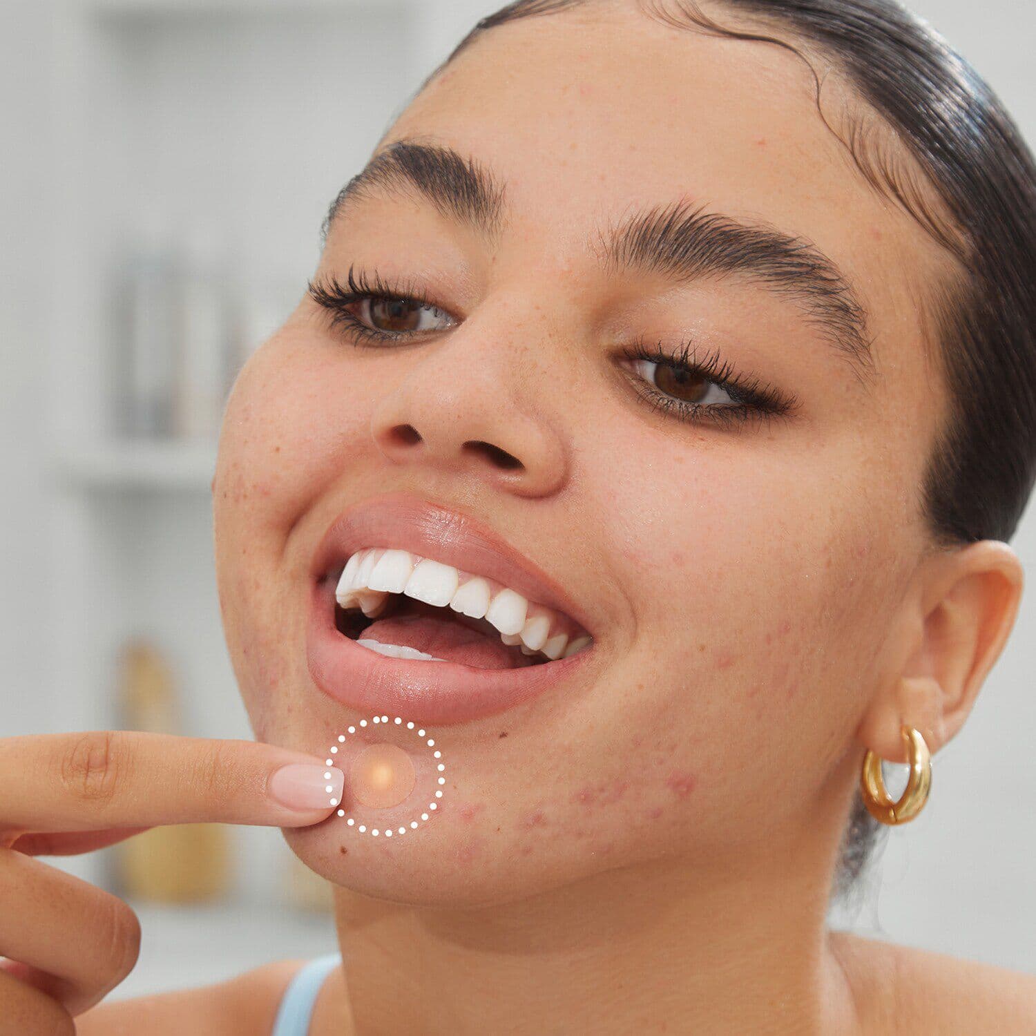 Acne Dots Jumbo