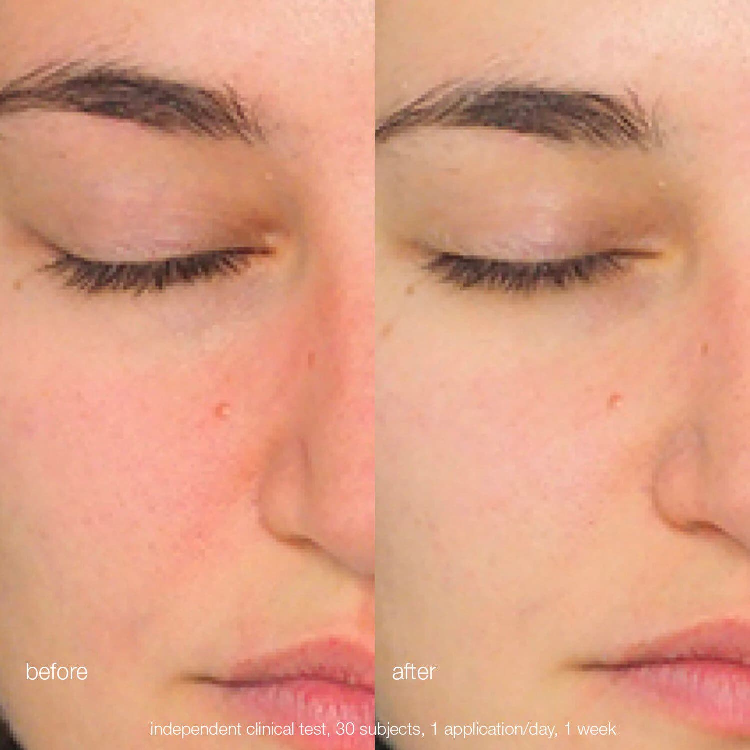 Daily Milkfoliant Exfoliator