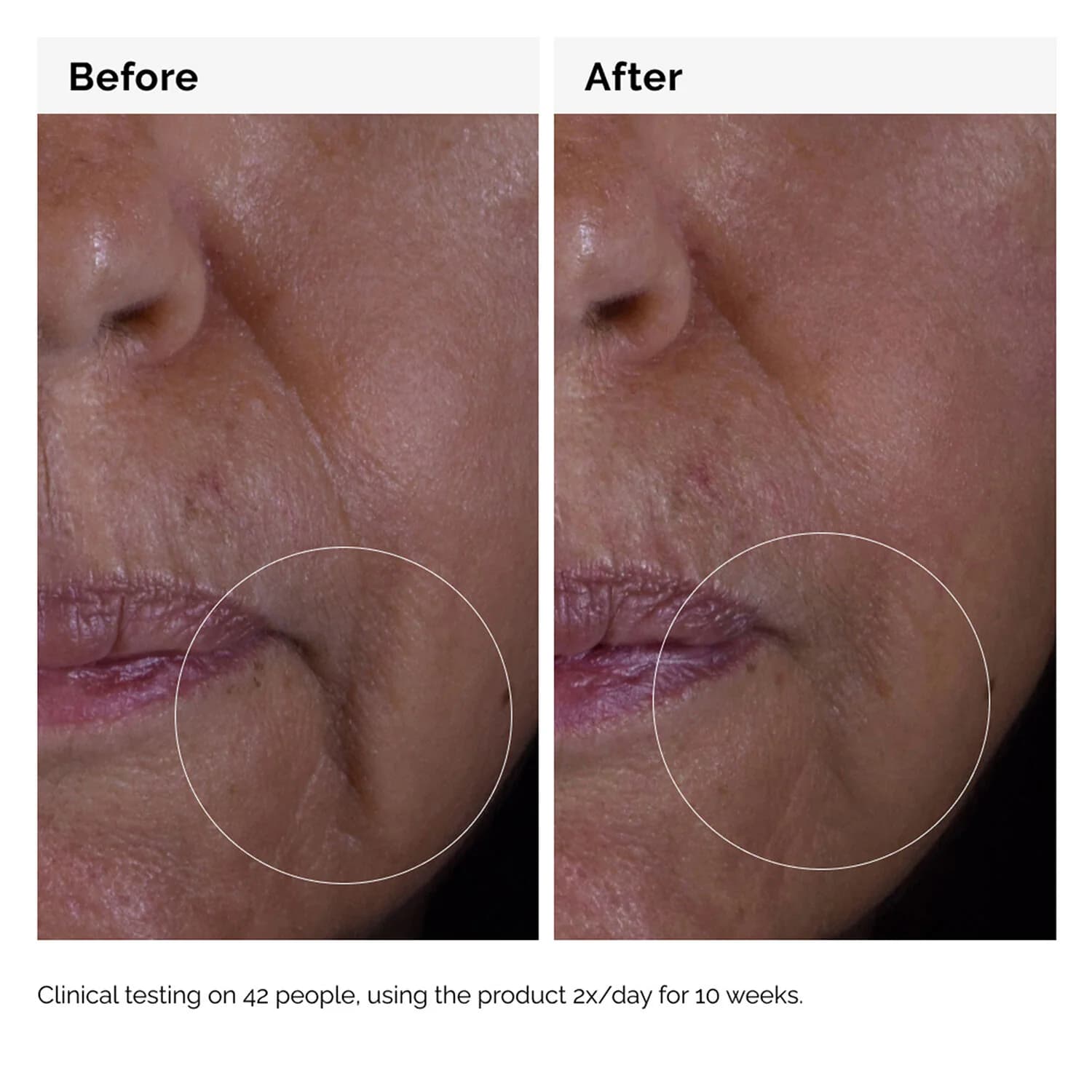 GF Solution 15% Serum