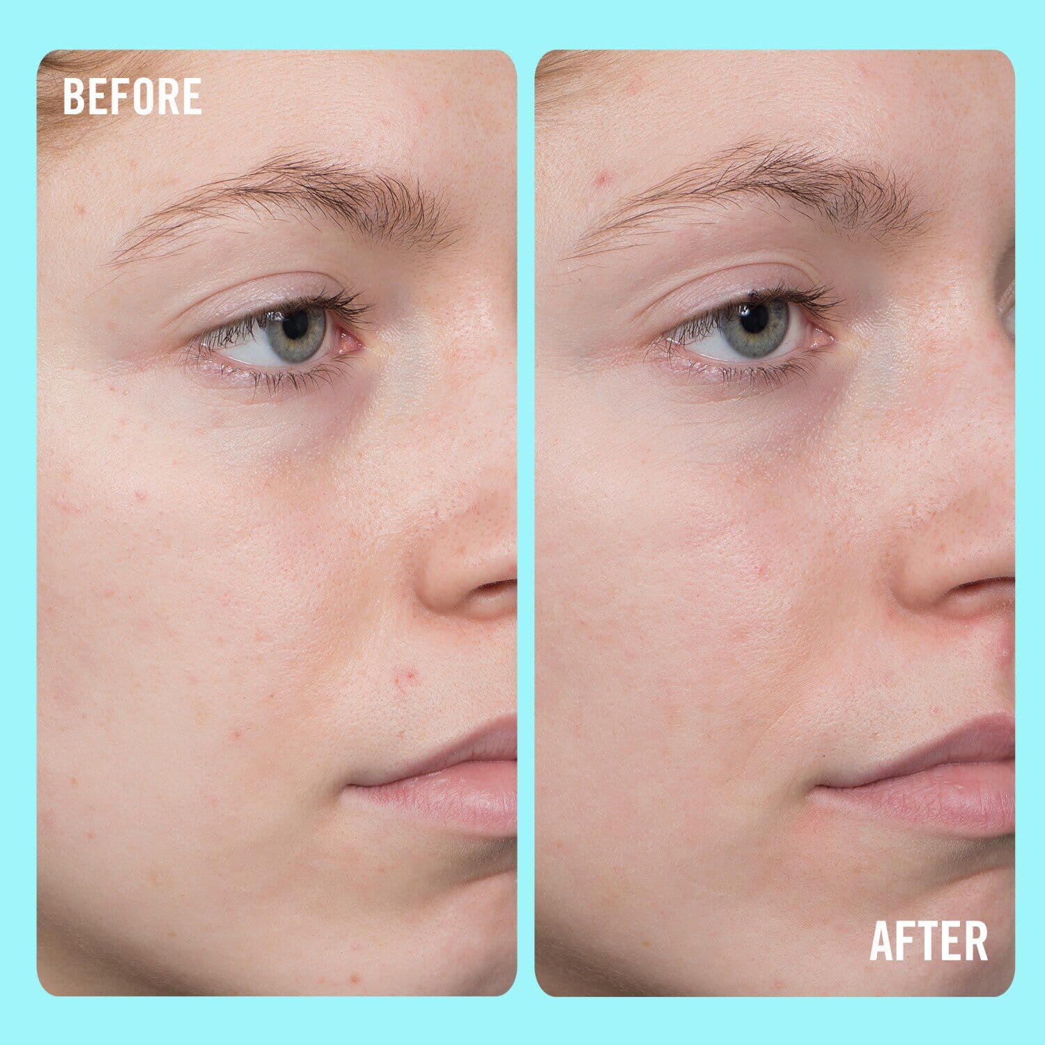 10% Vitamin C Brightening Serum