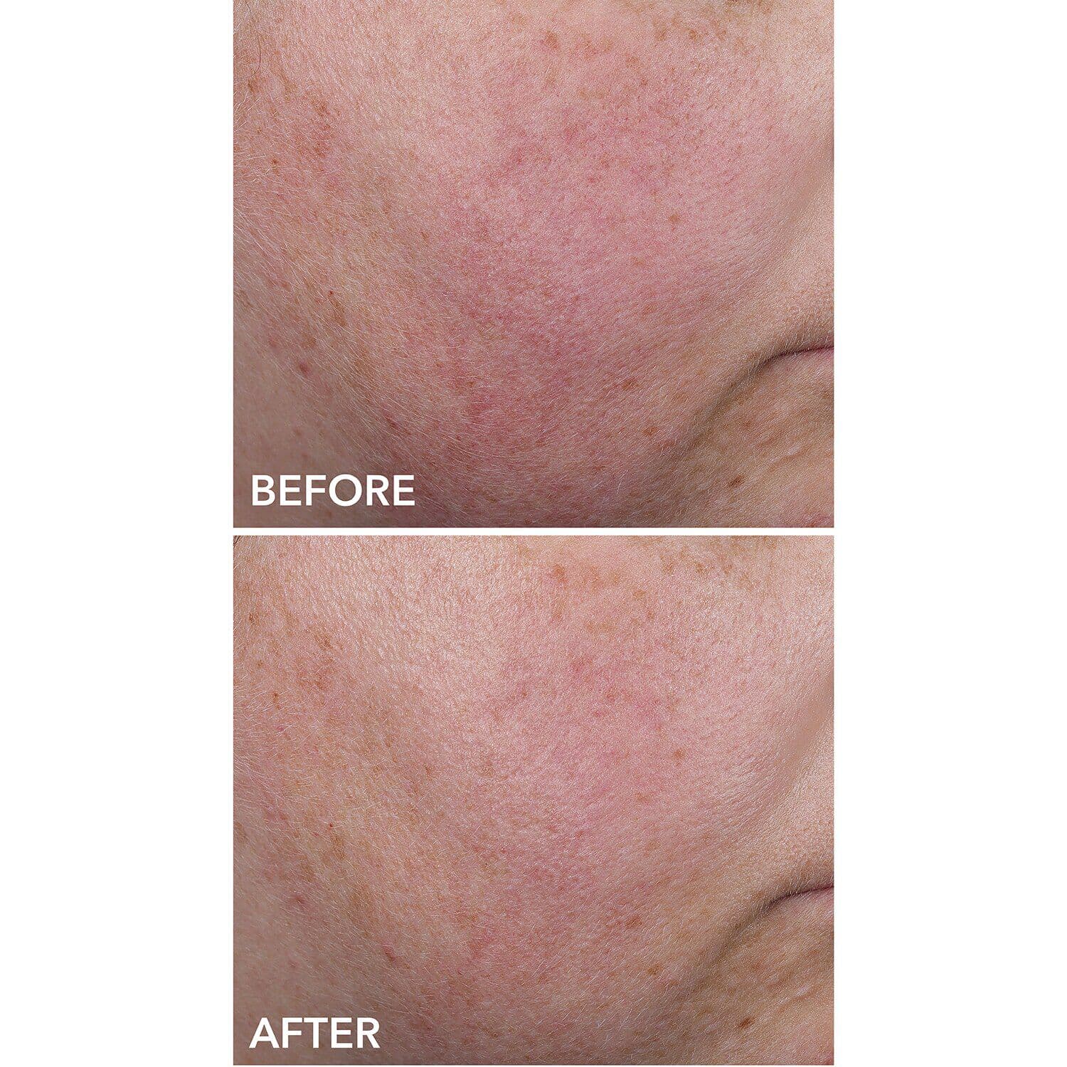 DermInfusions™ Blur + Repair Cream