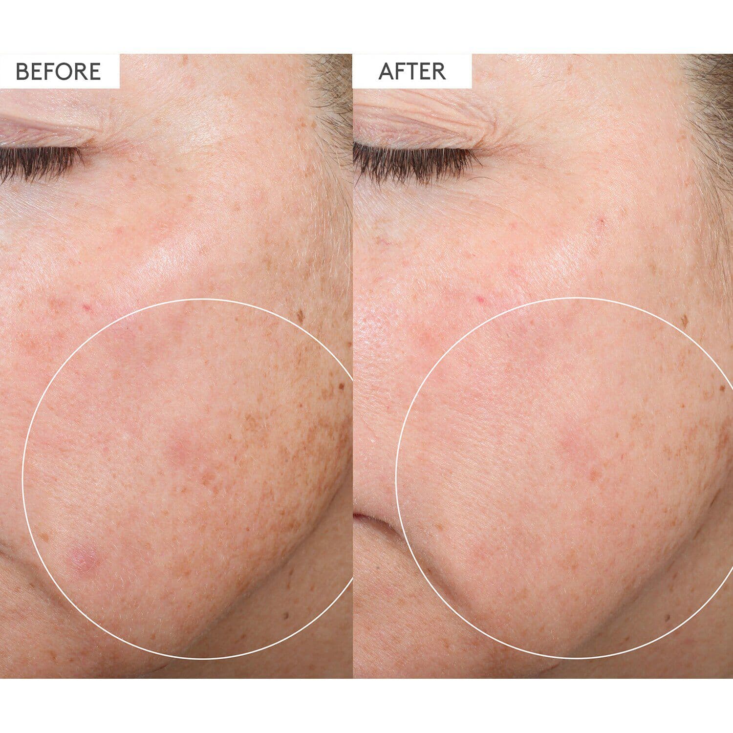 C-Firma™ Fresh Day Serum