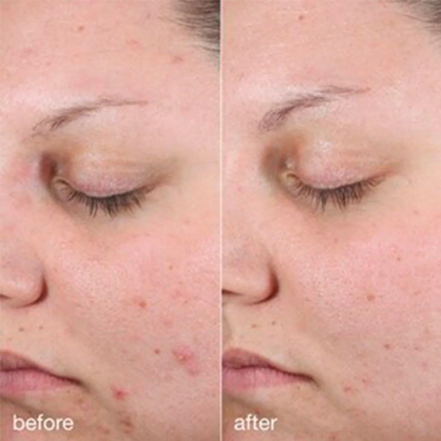 Age Bright Clearing Serum