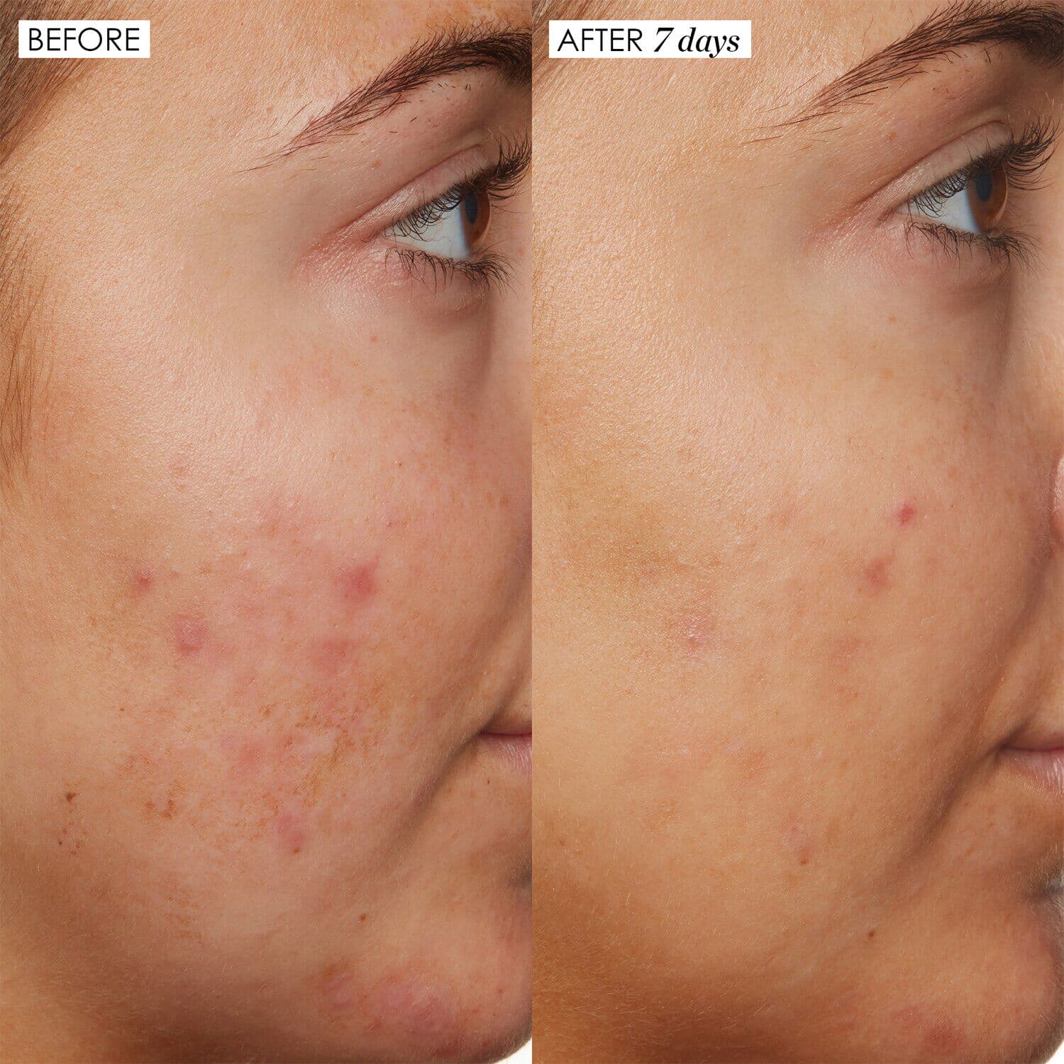 B3 Nice - 10% Niacinamide Serum