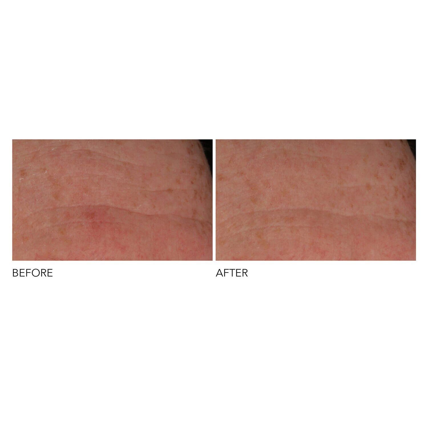 Advanced Retinol + Ferulic Overnight Wrinkle Treatment