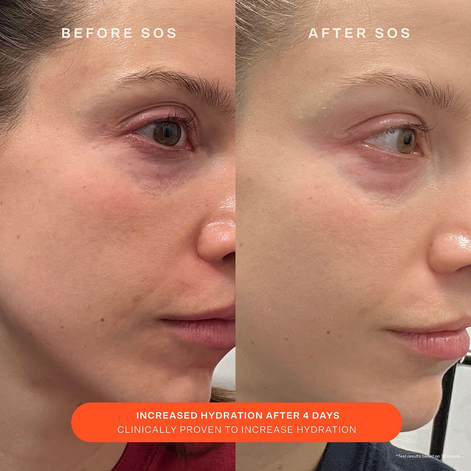 SOS Daily Barrier Recovery Cream - Facial Moisturizer