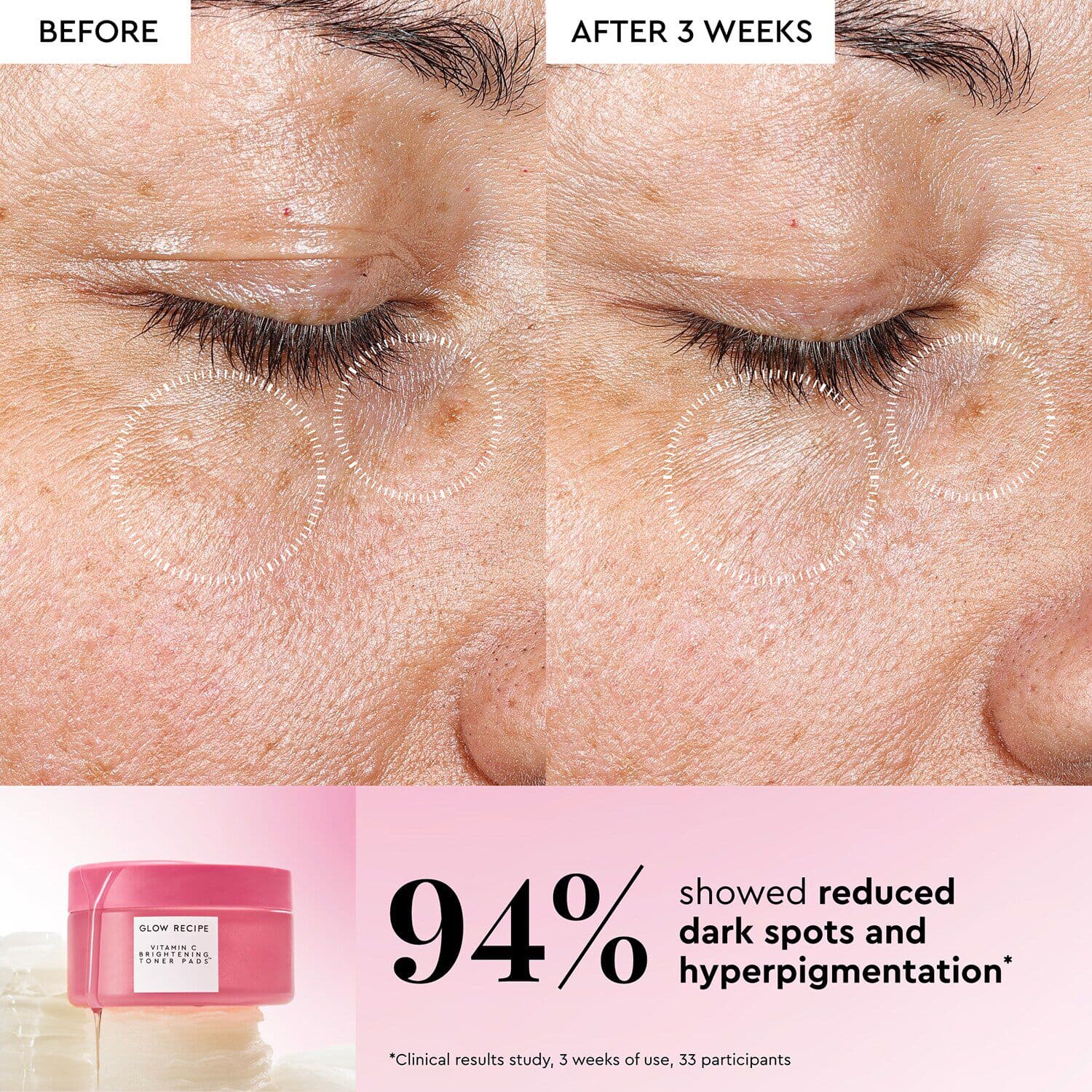 Vitamin C Brightening Korean Toner Pads for Undereye & Cheeks