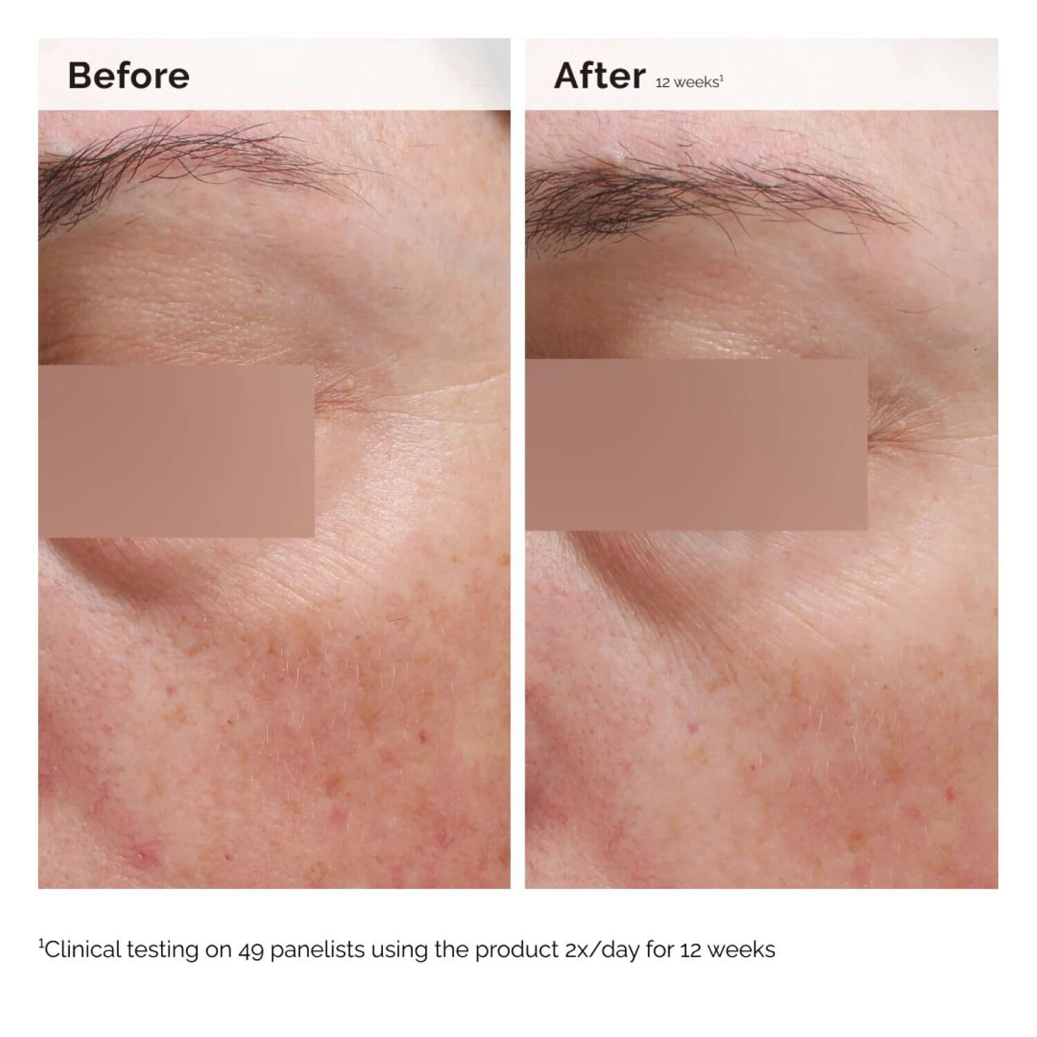 Niacinamide 5% Face & Body Emulsion