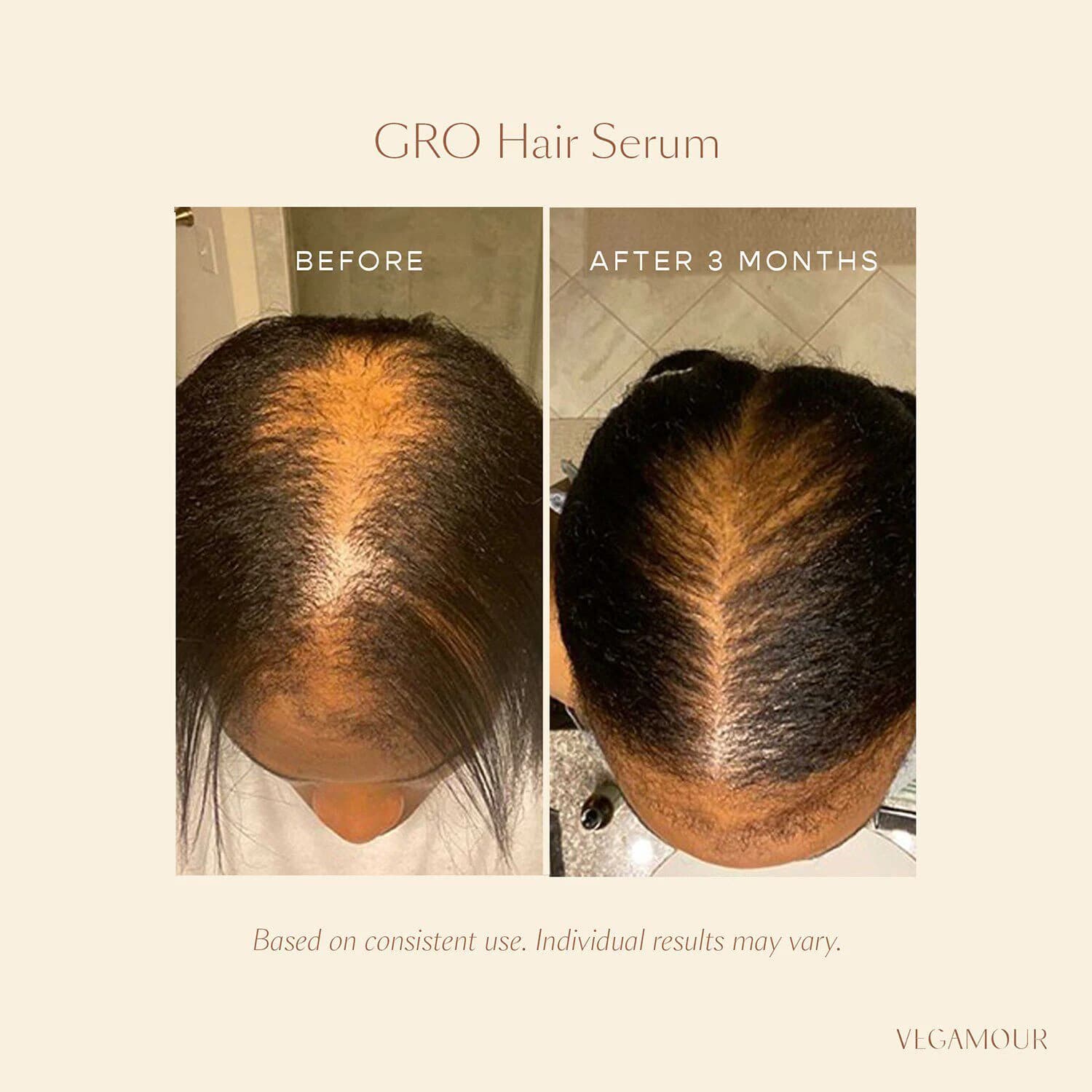 GRO Hair Serum