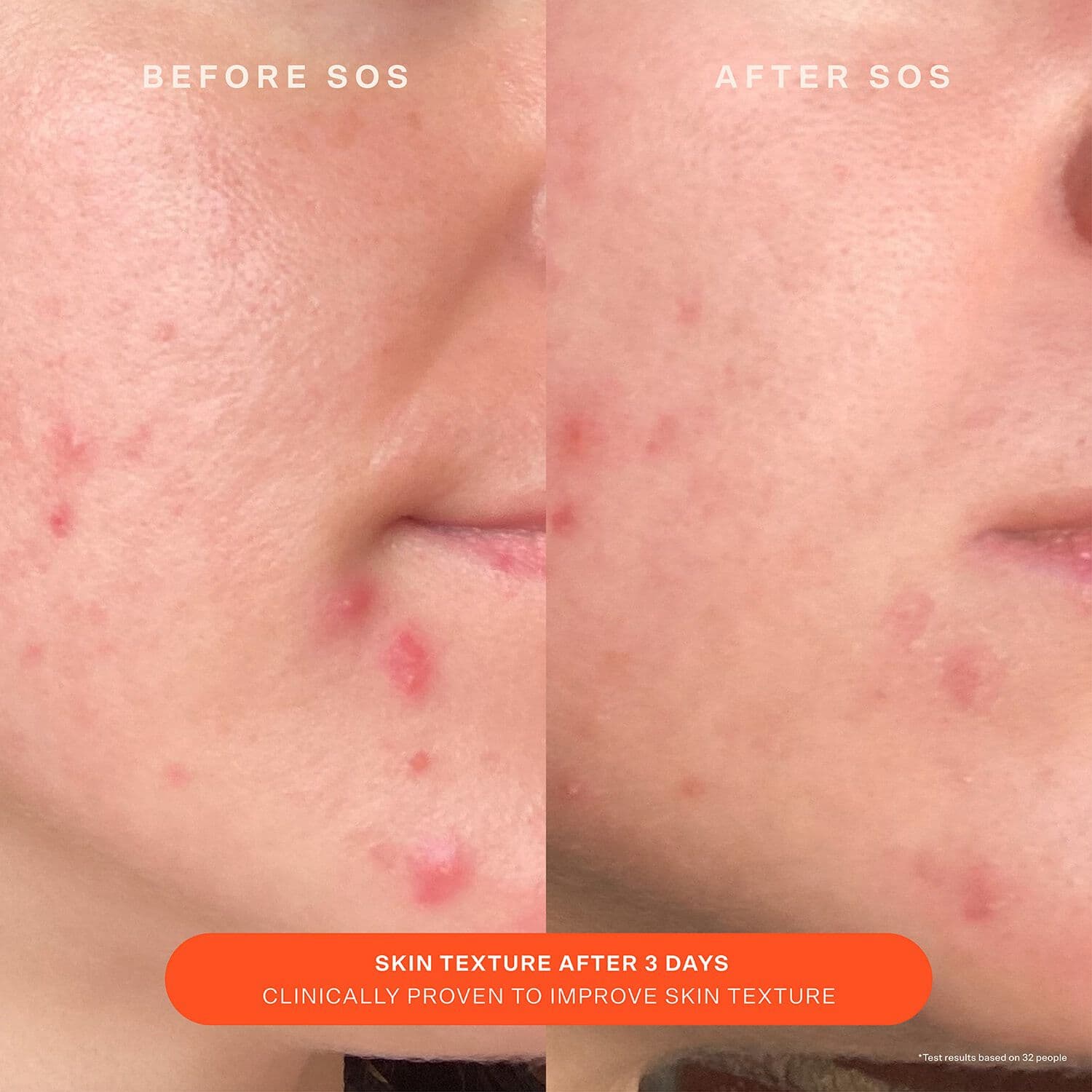 SOS Daily Barrier Recovery Cream - Facial Moisturizer