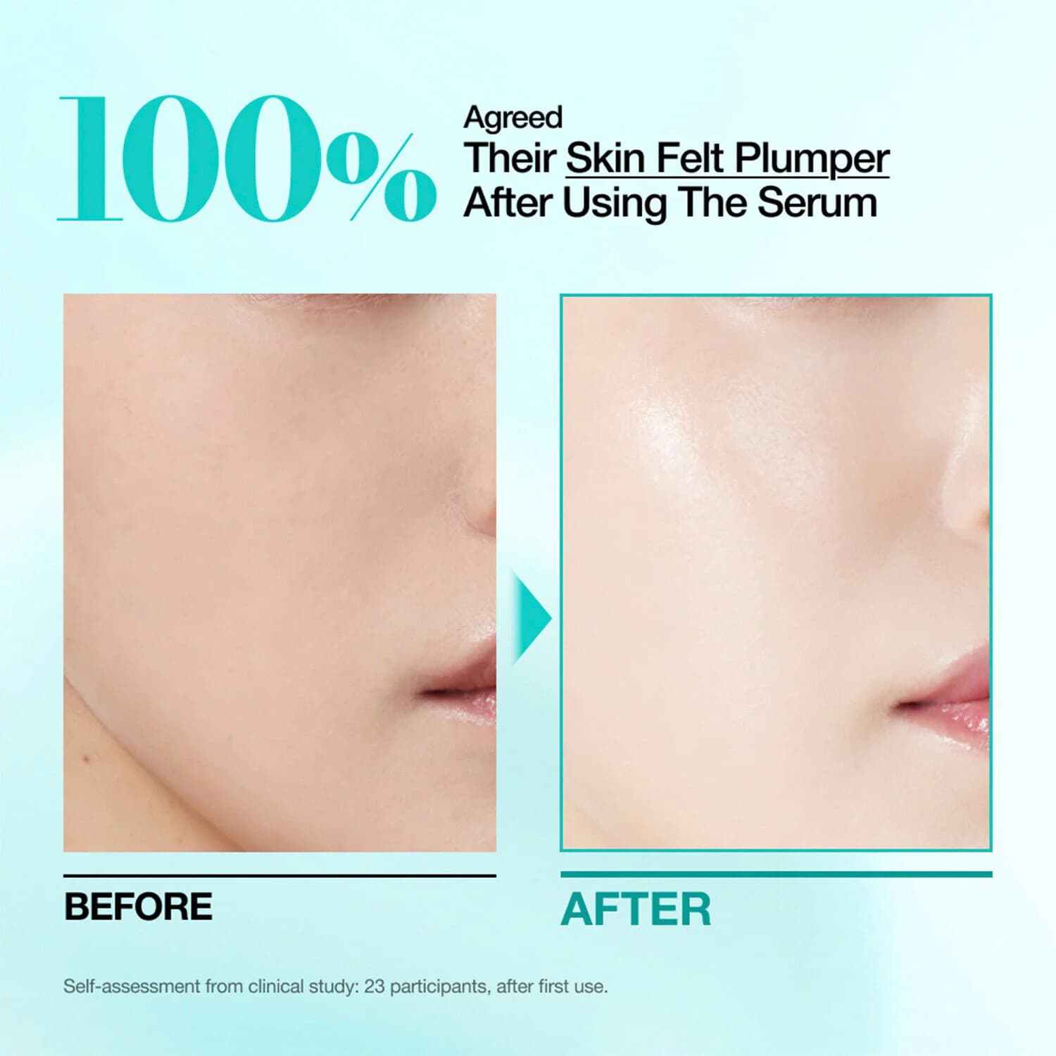 Mini for Plumping