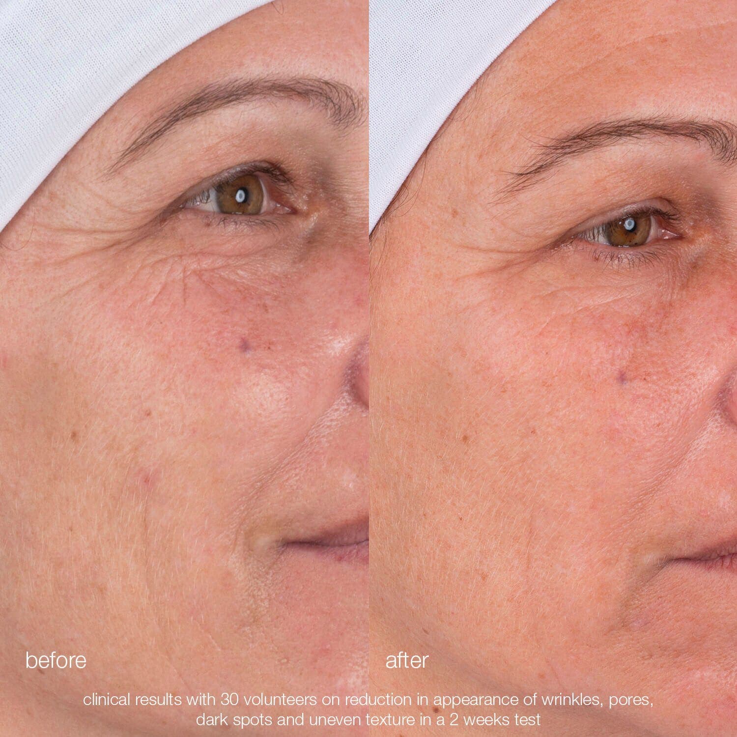 Dynamic Skin Retinol Serum