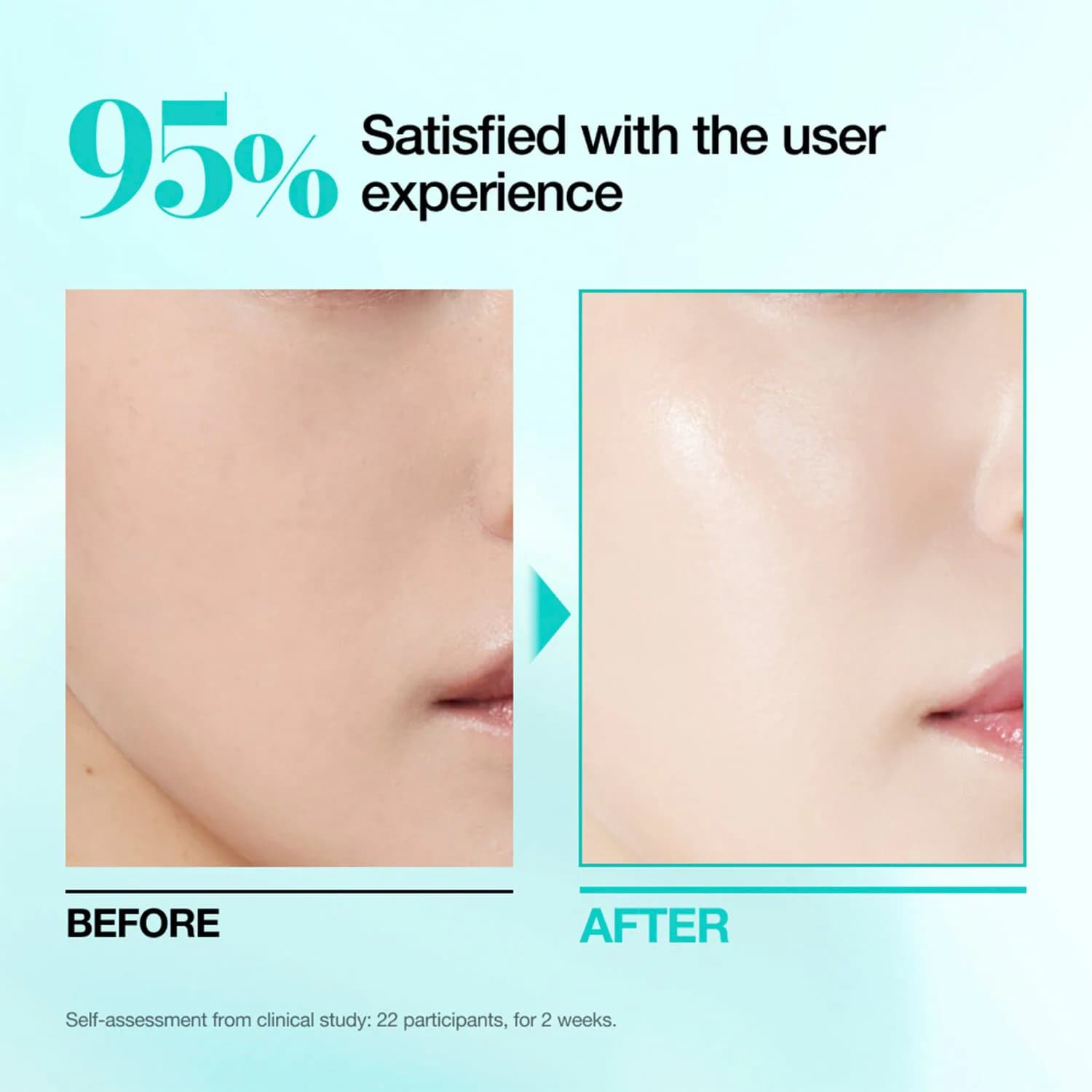 PDRN Hyaluronic Acid Capsule 100 Serum Mask