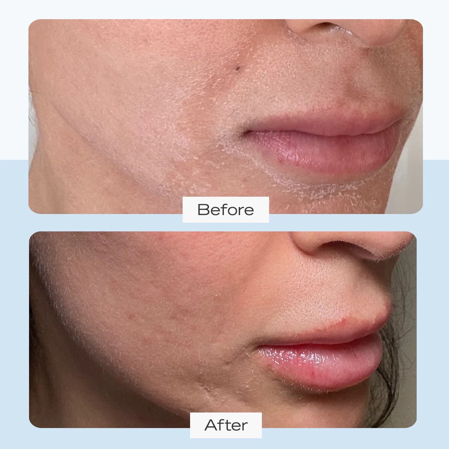 Ultra Repair Cream