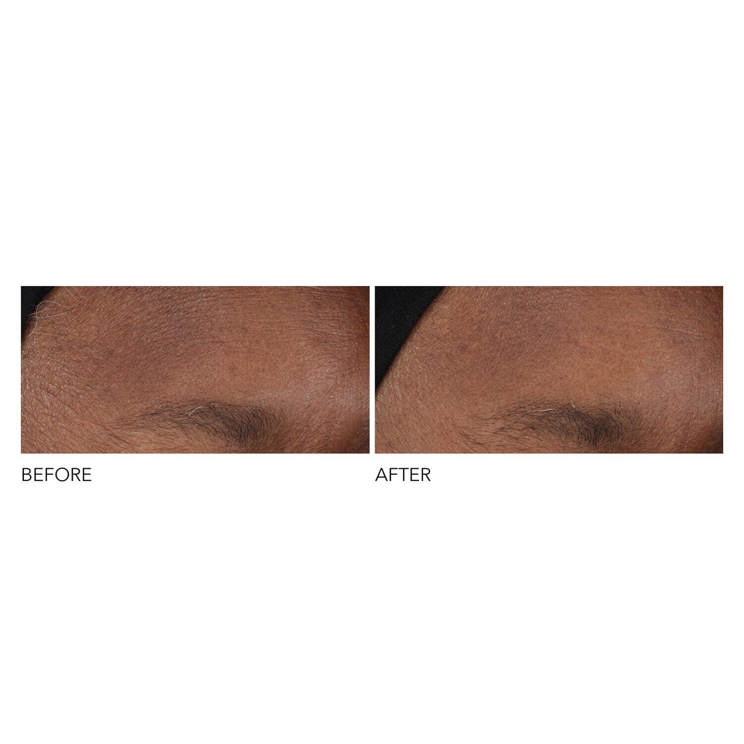 Advanced Retinol + Ferulic Overnight Wrinkle Treatment