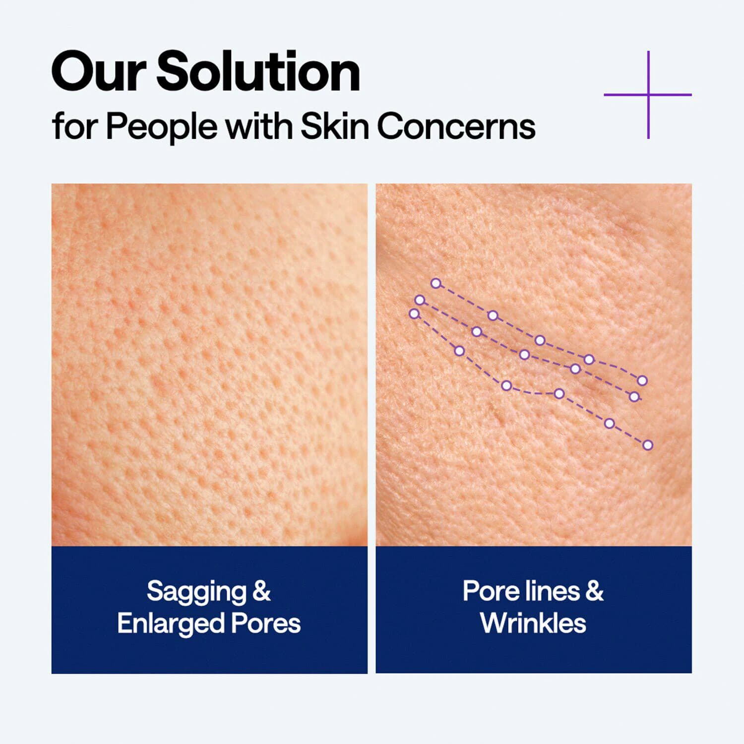 PDRN Serum