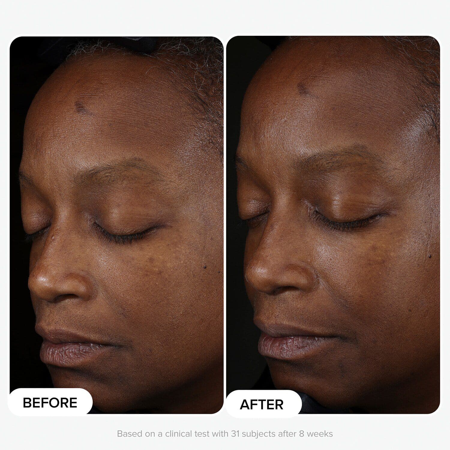 10% Niacinamide Booster
