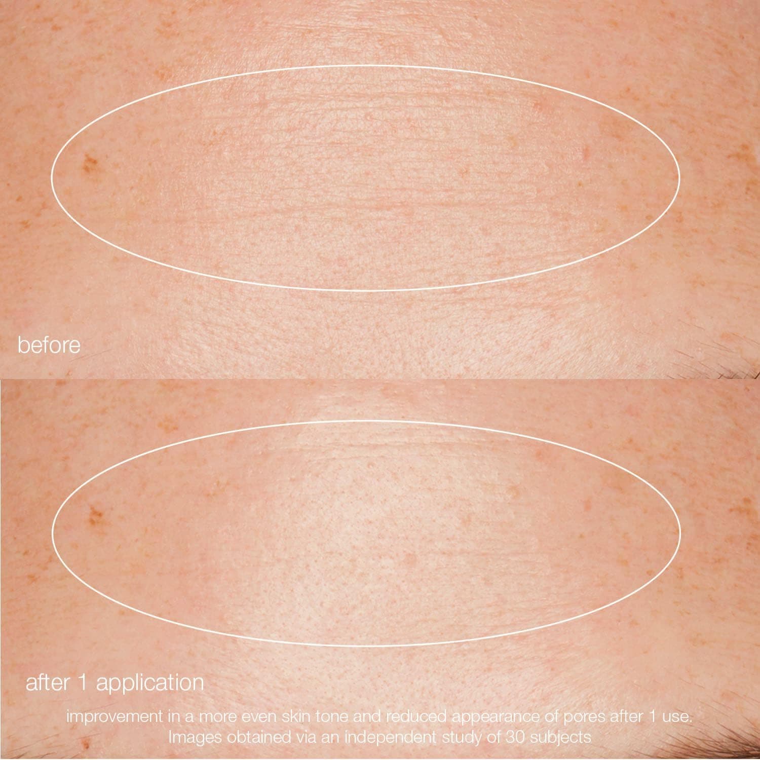 Liquid Peelfoliant
