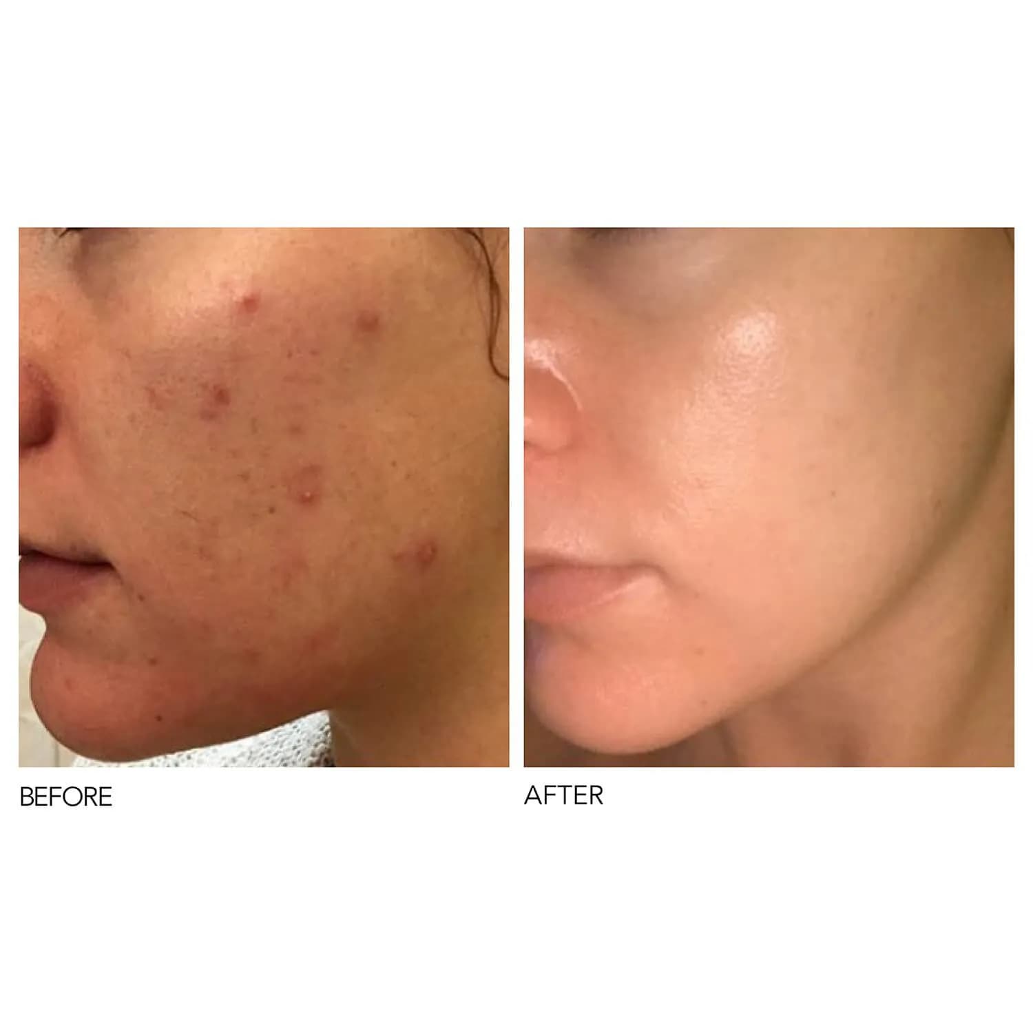 Alpha Beta® Peel Extra Strength Daily Peel