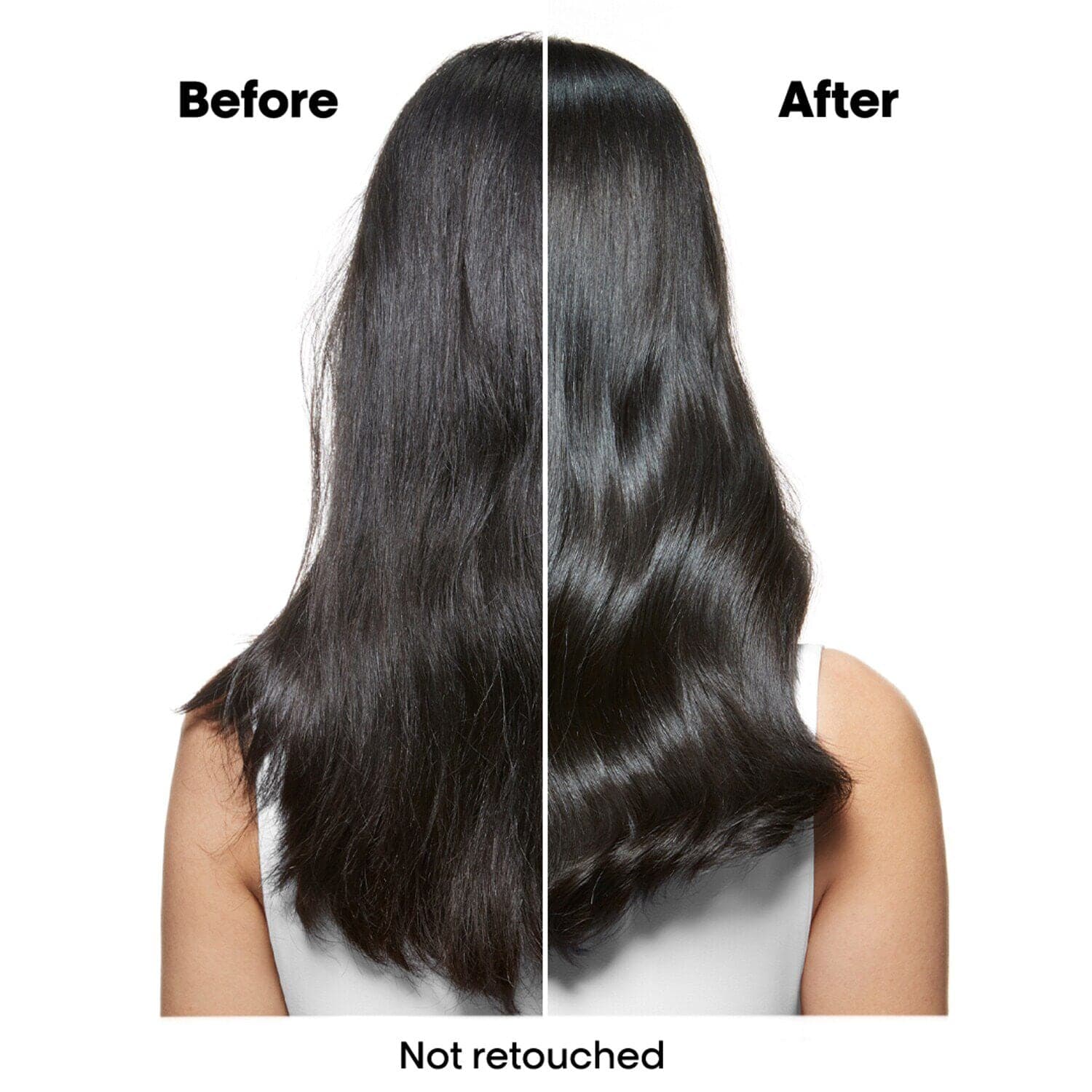 Scalp Advanced Anti-Dandruff Shampoo, For Dandruff Scalps