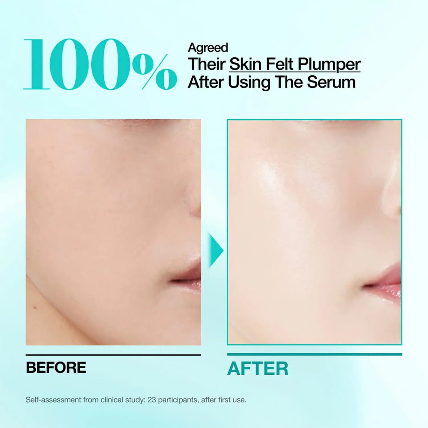 PDRN Hyaluronic Acid Capsule 100 Serum