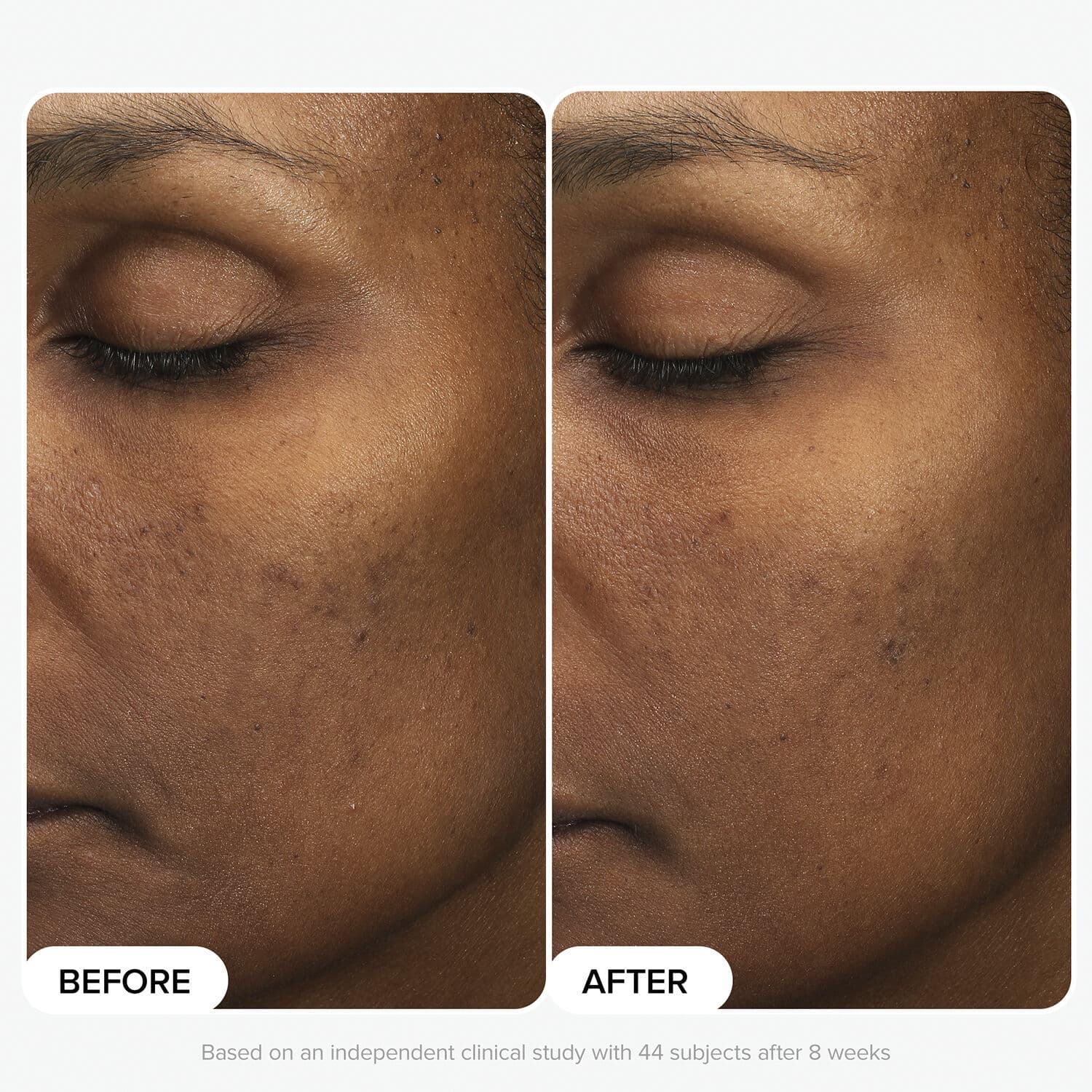 Multi-Level Exfoliation Trial Kit