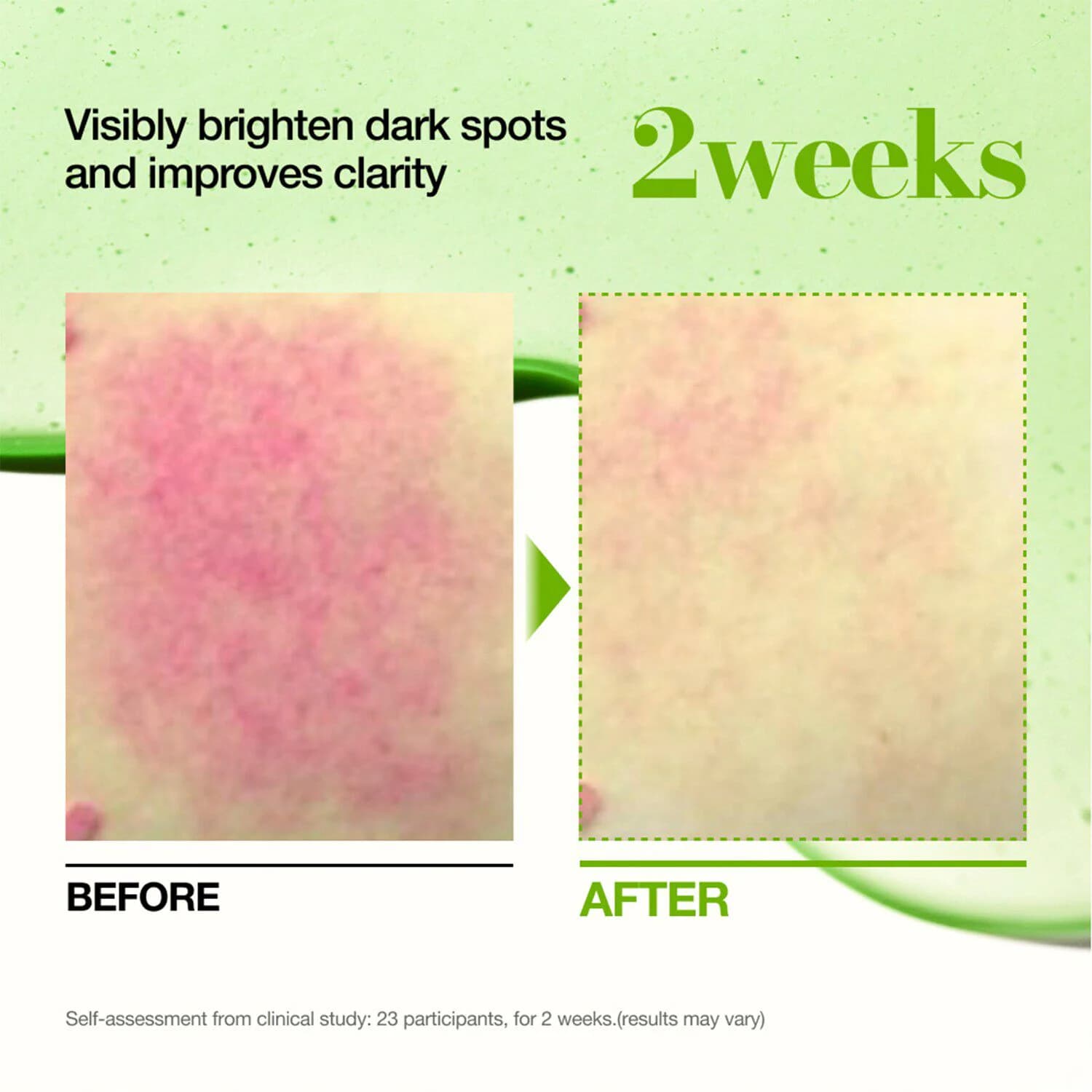 Azelaic Acid 10 Hyaluron Redness Soothing Serum